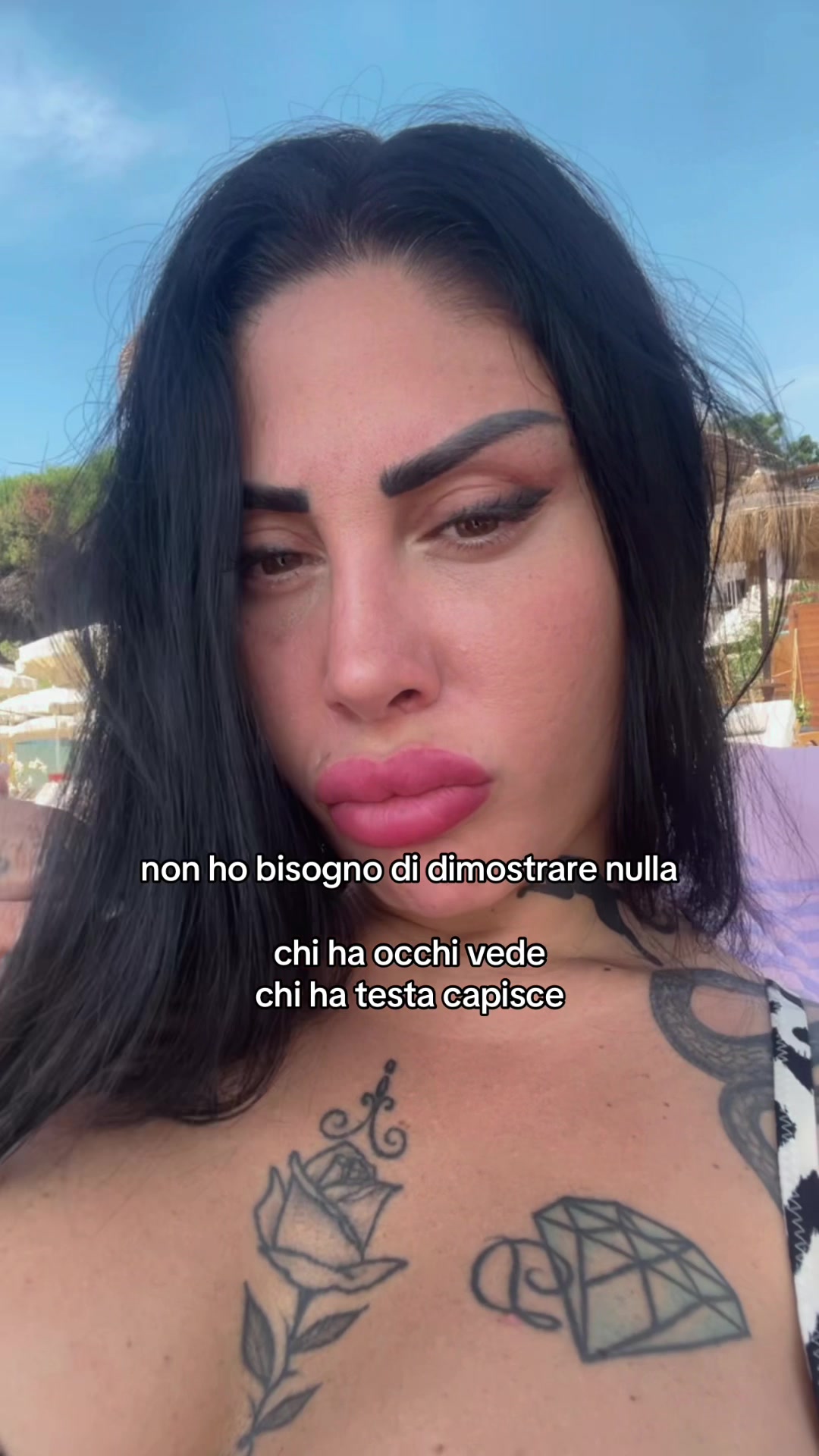 @Alessia 🙈🙉🙊