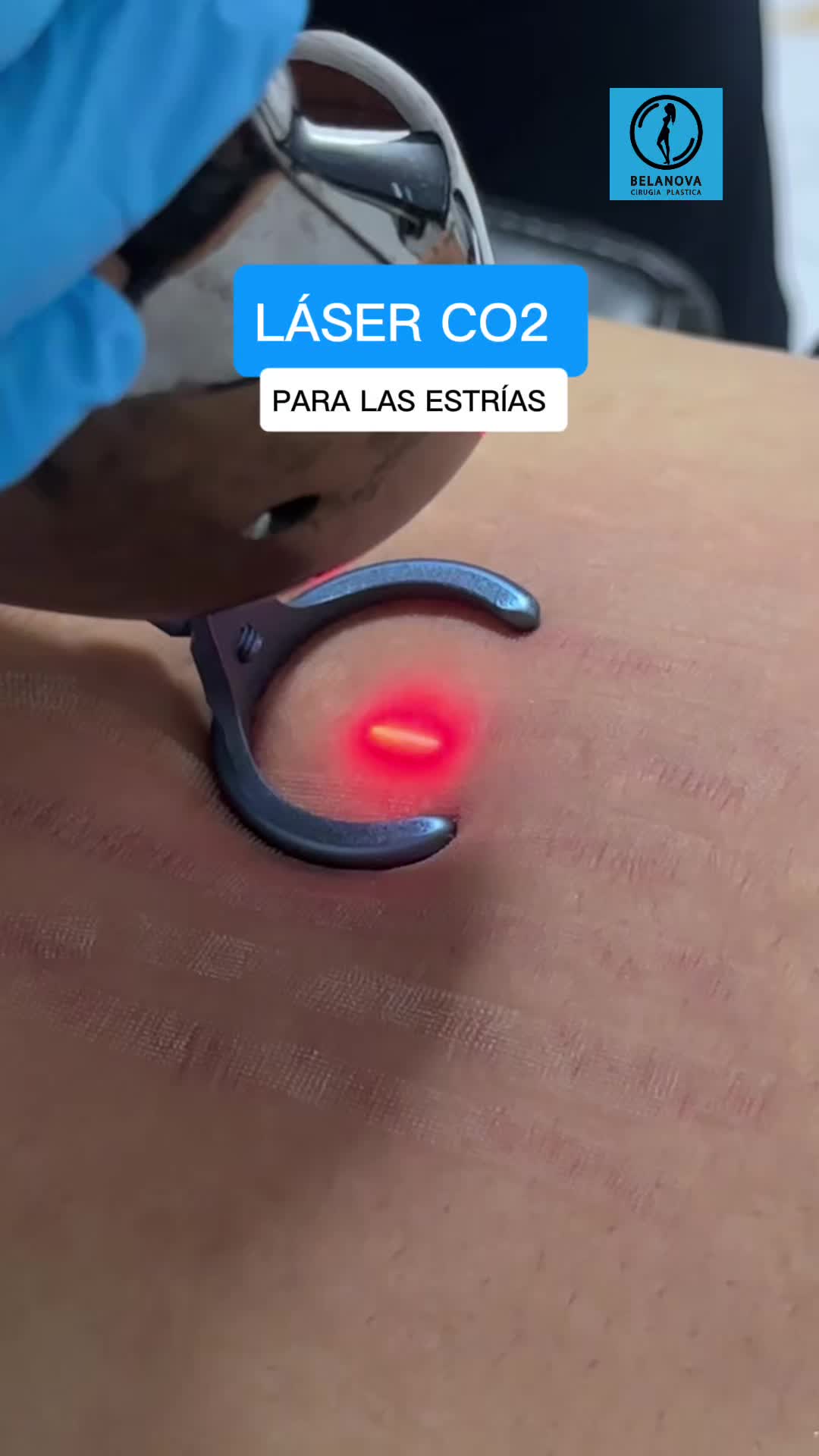 @Belanovacirugiaplastica