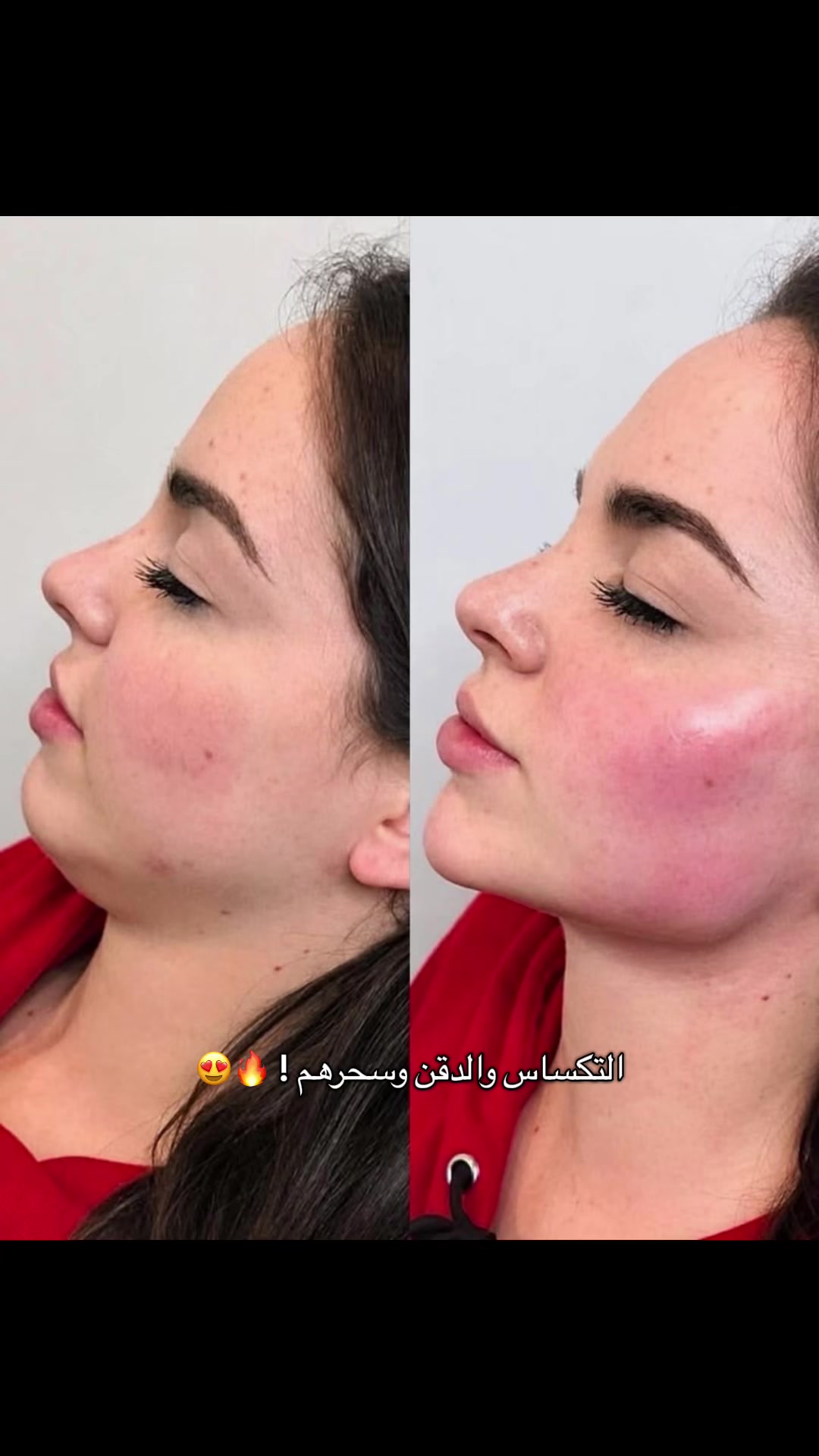 @مراس فرع النزهة