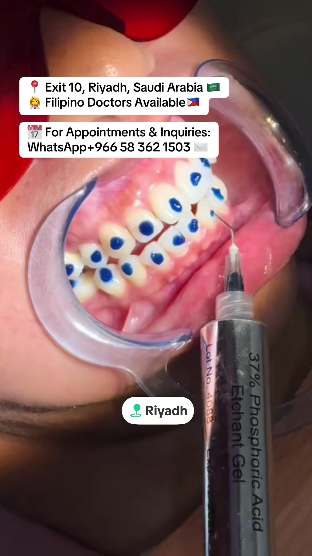 @DENTAL&DERMA CLINIC RIYADH🇸🇦
