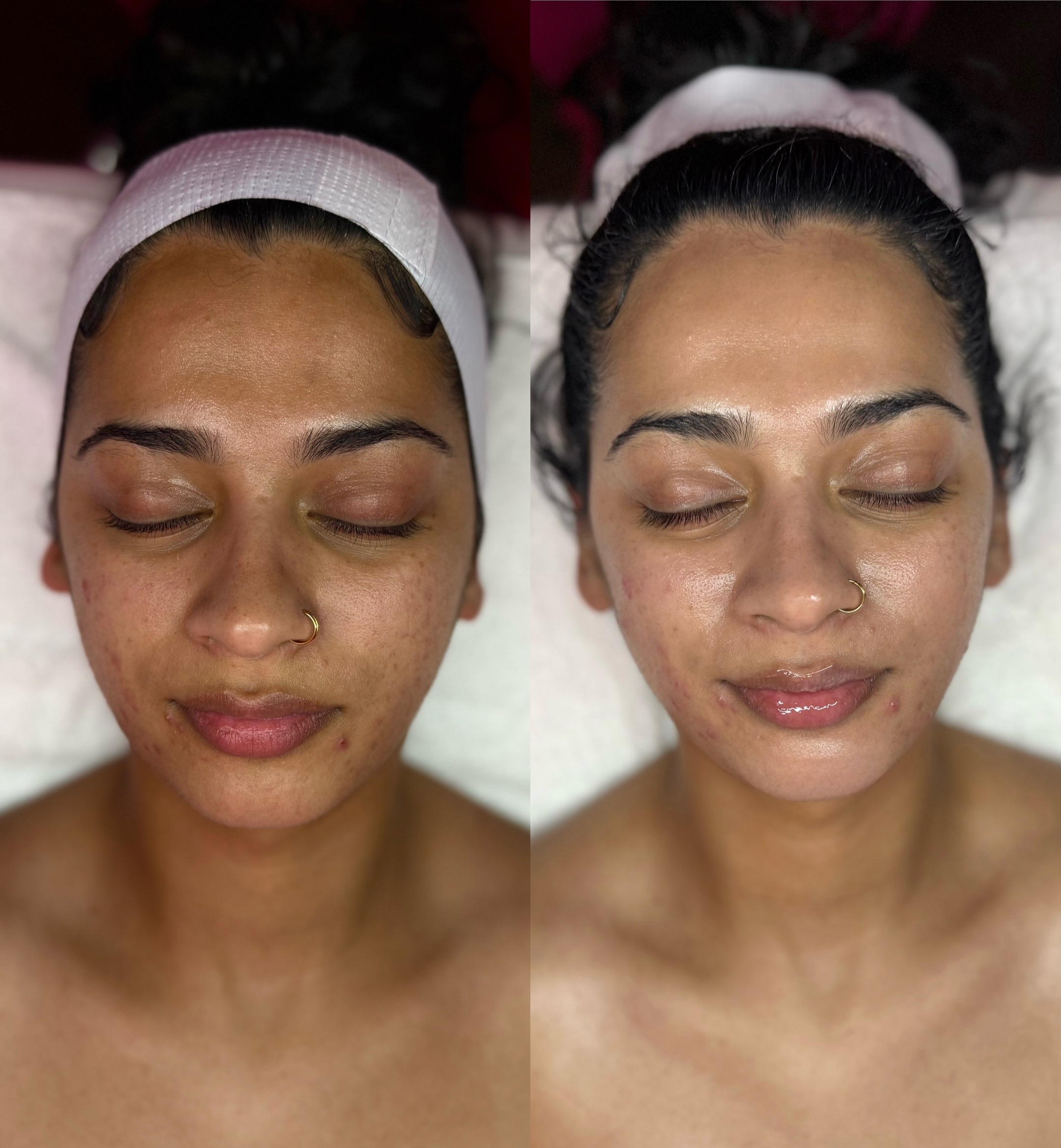 @HappySkinBySara