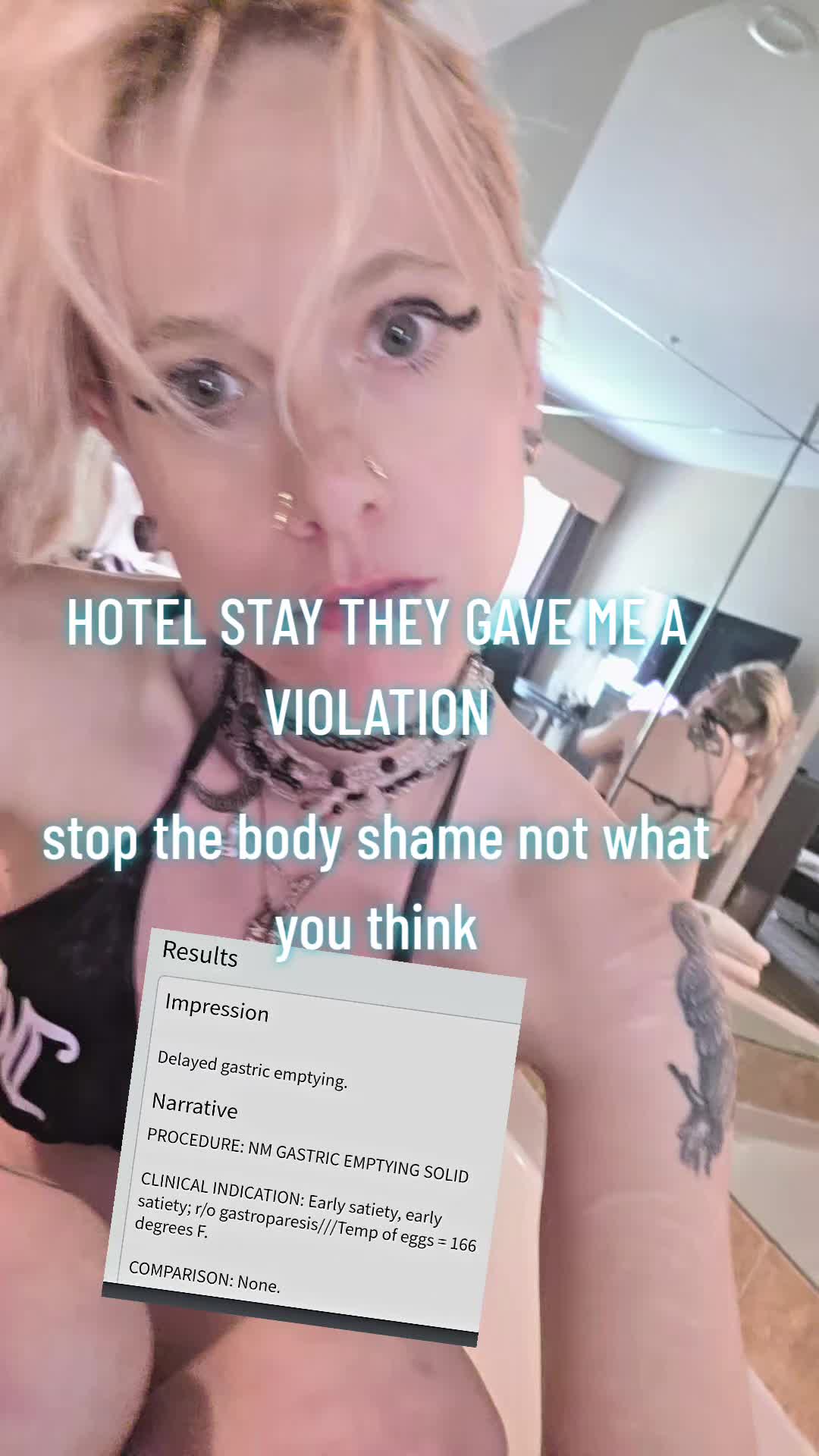 @Cobra