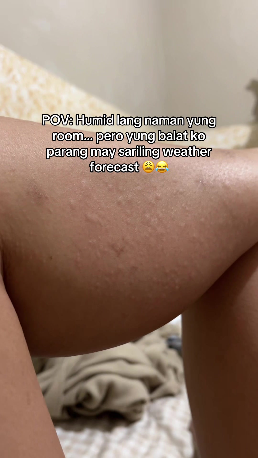@Ems