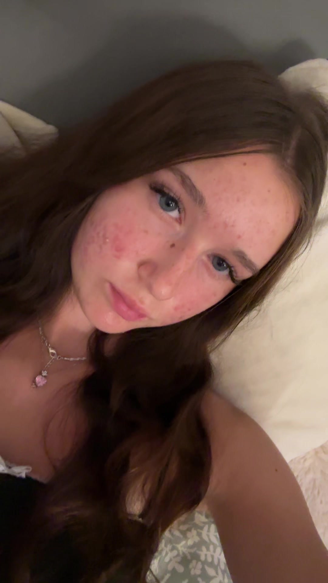 @🙈