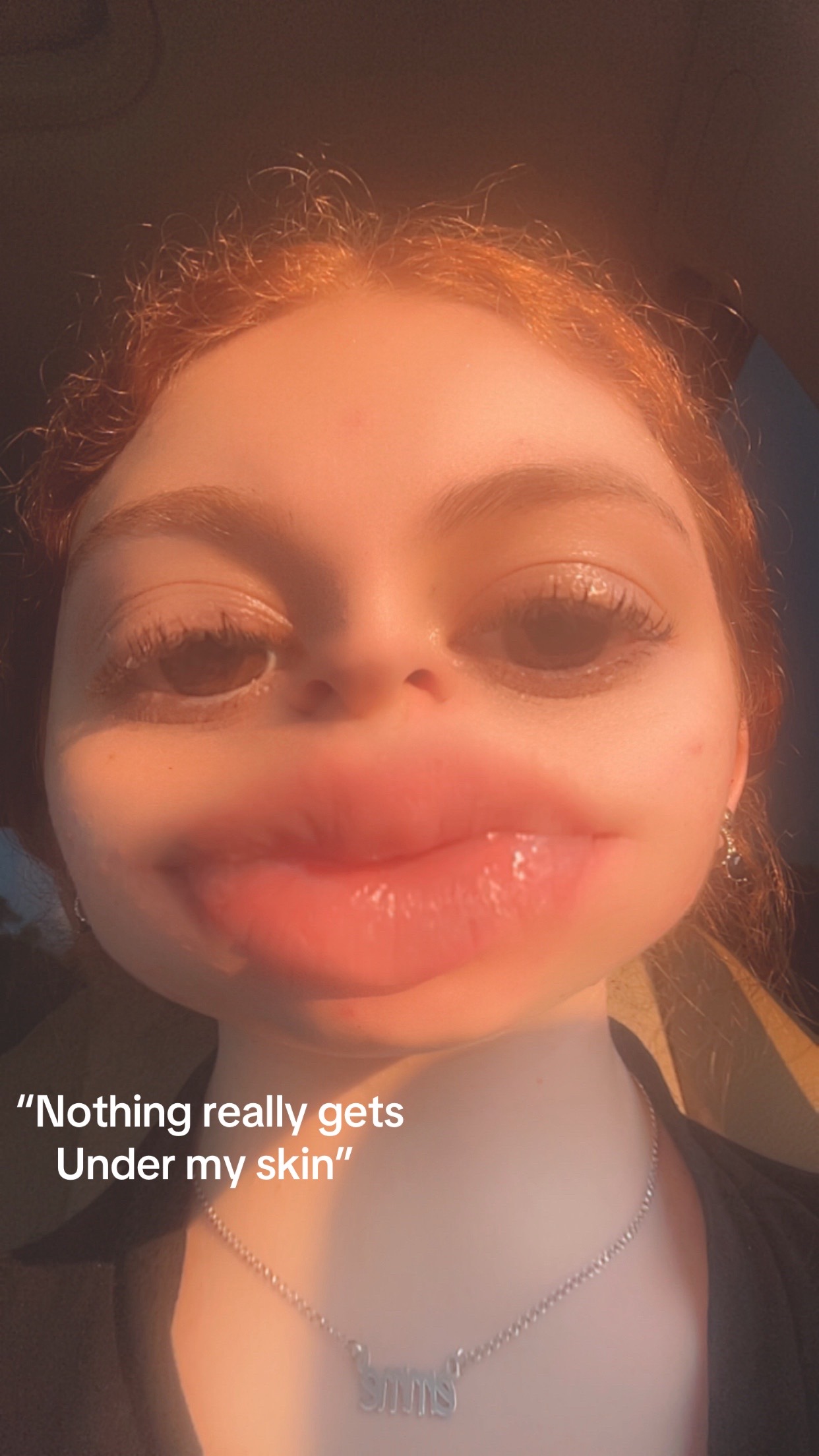@sk3letons