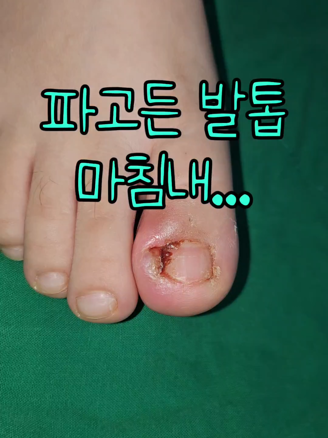 @아문성형외과