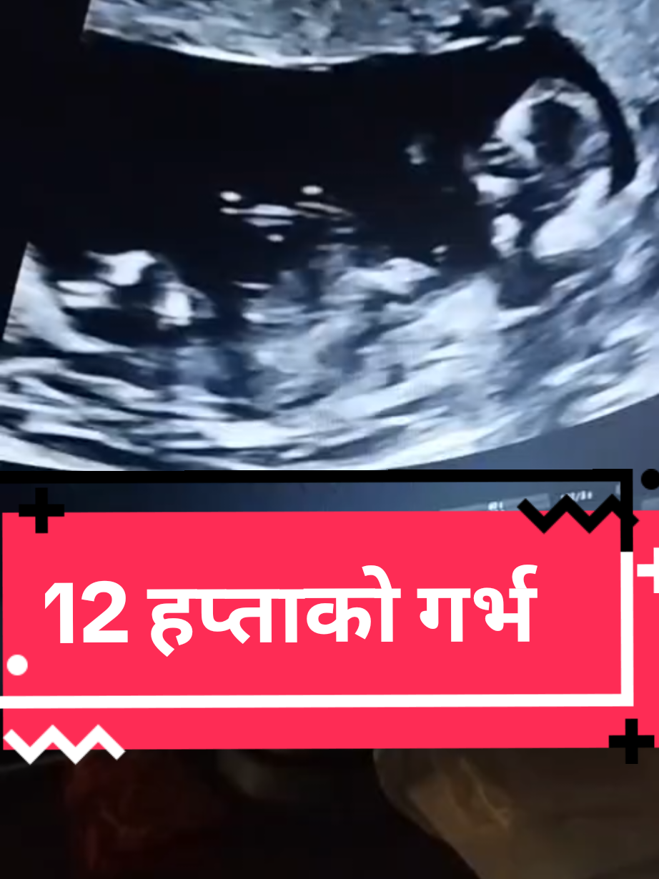@Dr Jyoti