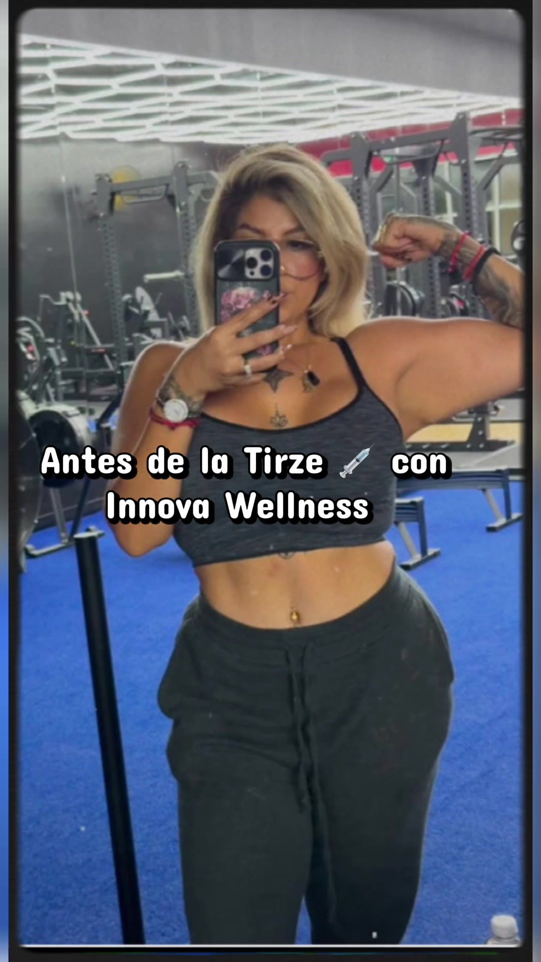 @Ana