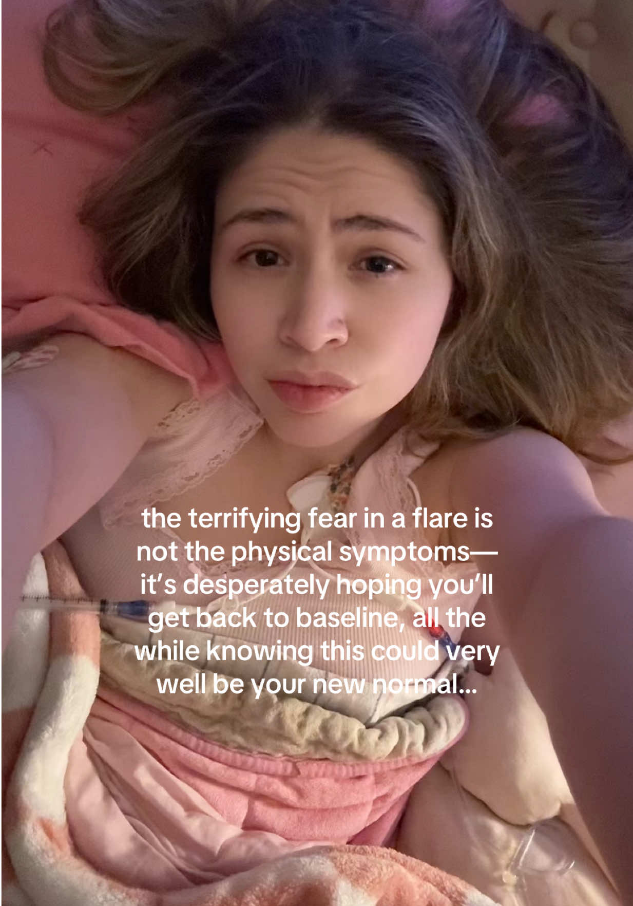 @Alexa