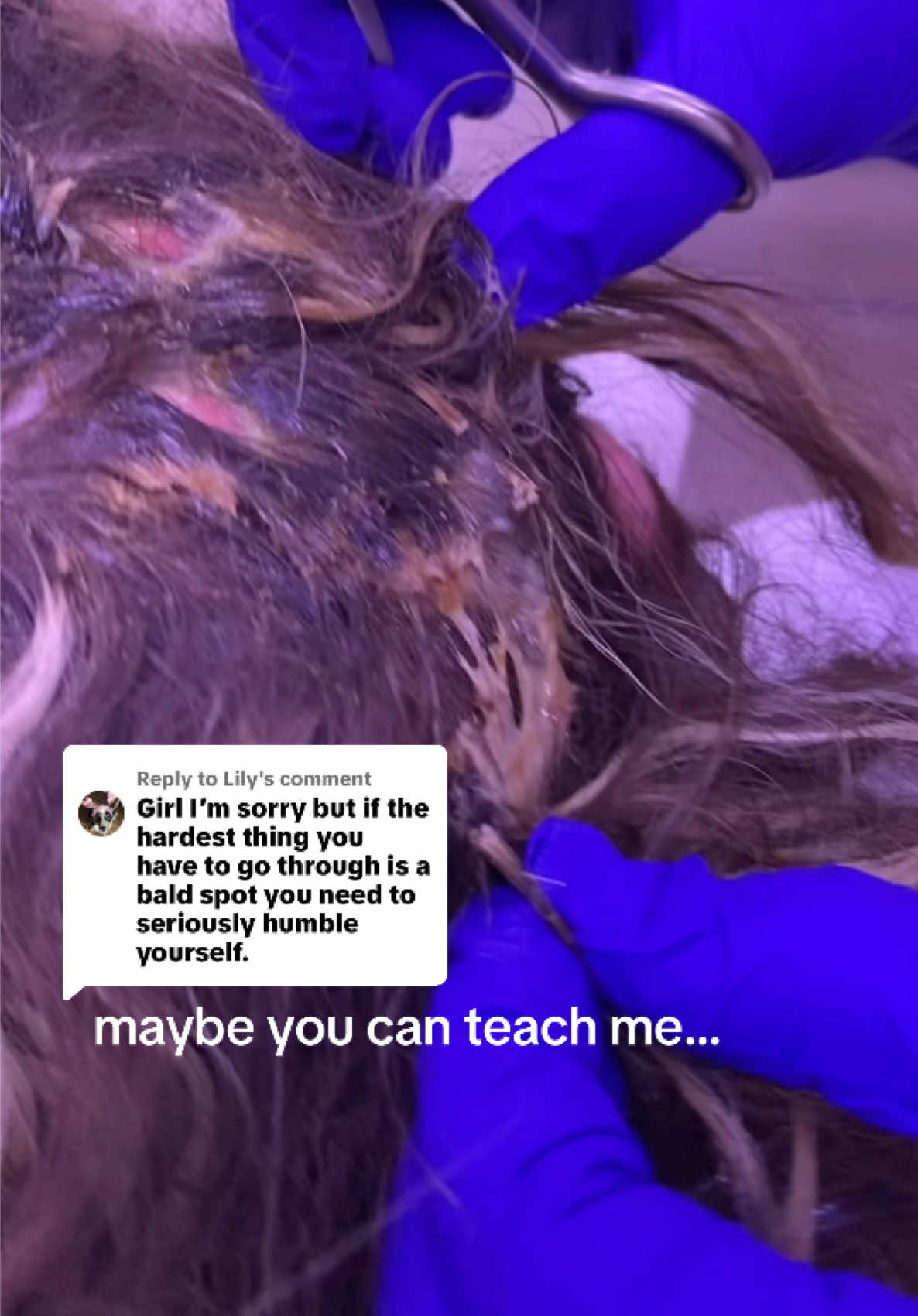 @coco❤️&zwj;🩹and💇&zwj;♀️burt.the.burn