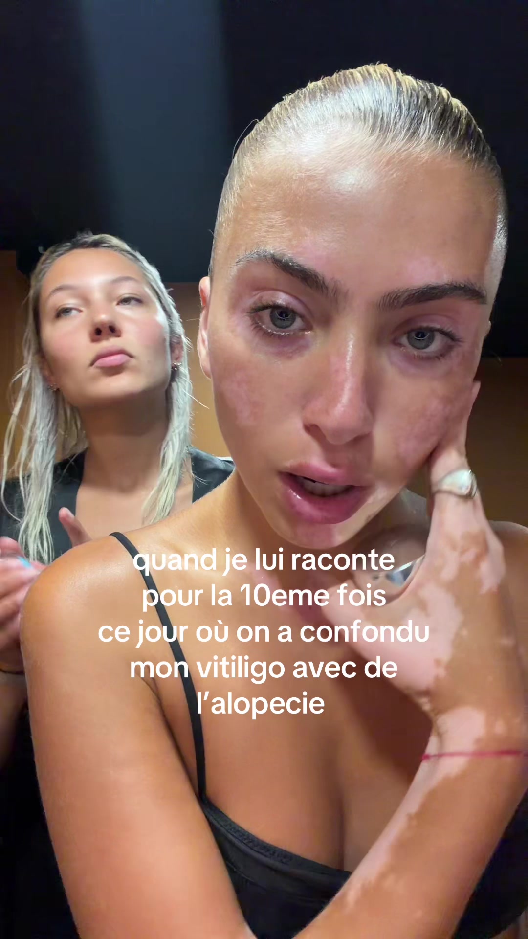 @Loeva