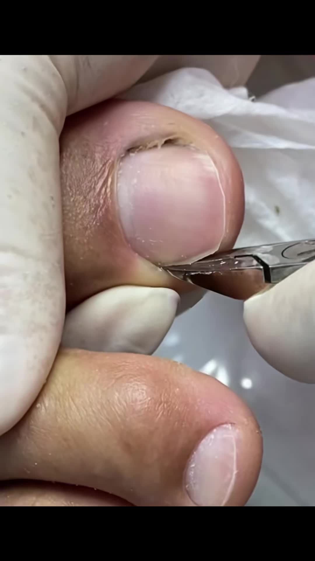 @Toenails.clips