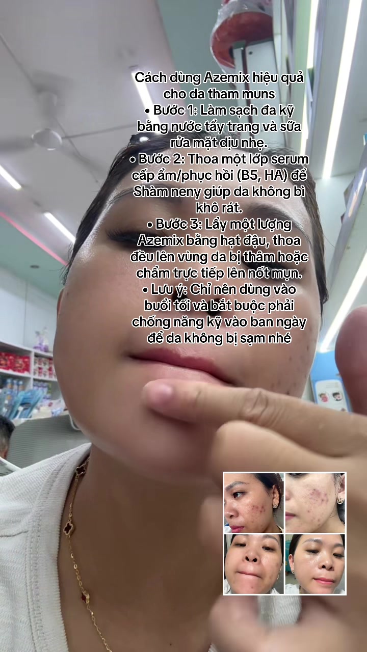 @Hoa Acne Skincare🌷