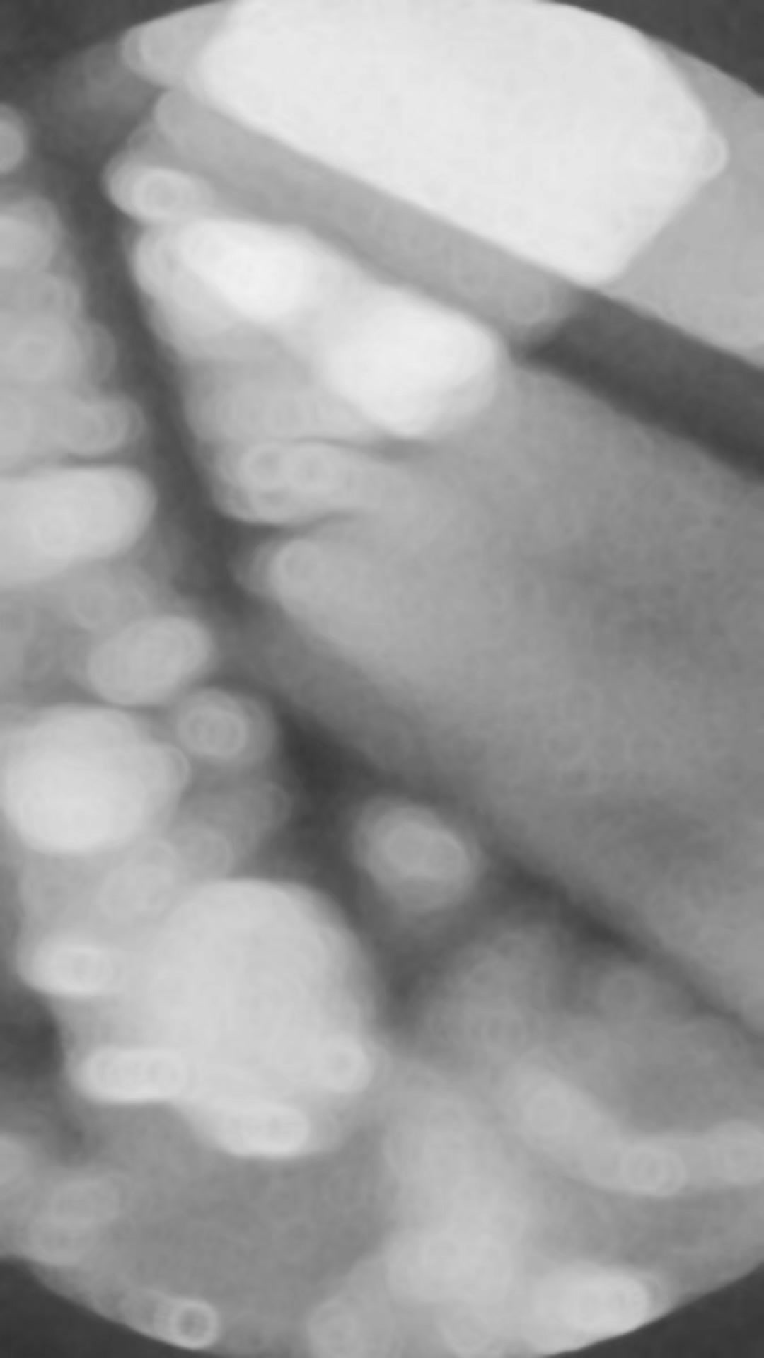 @〘OF〙fACEk1ng