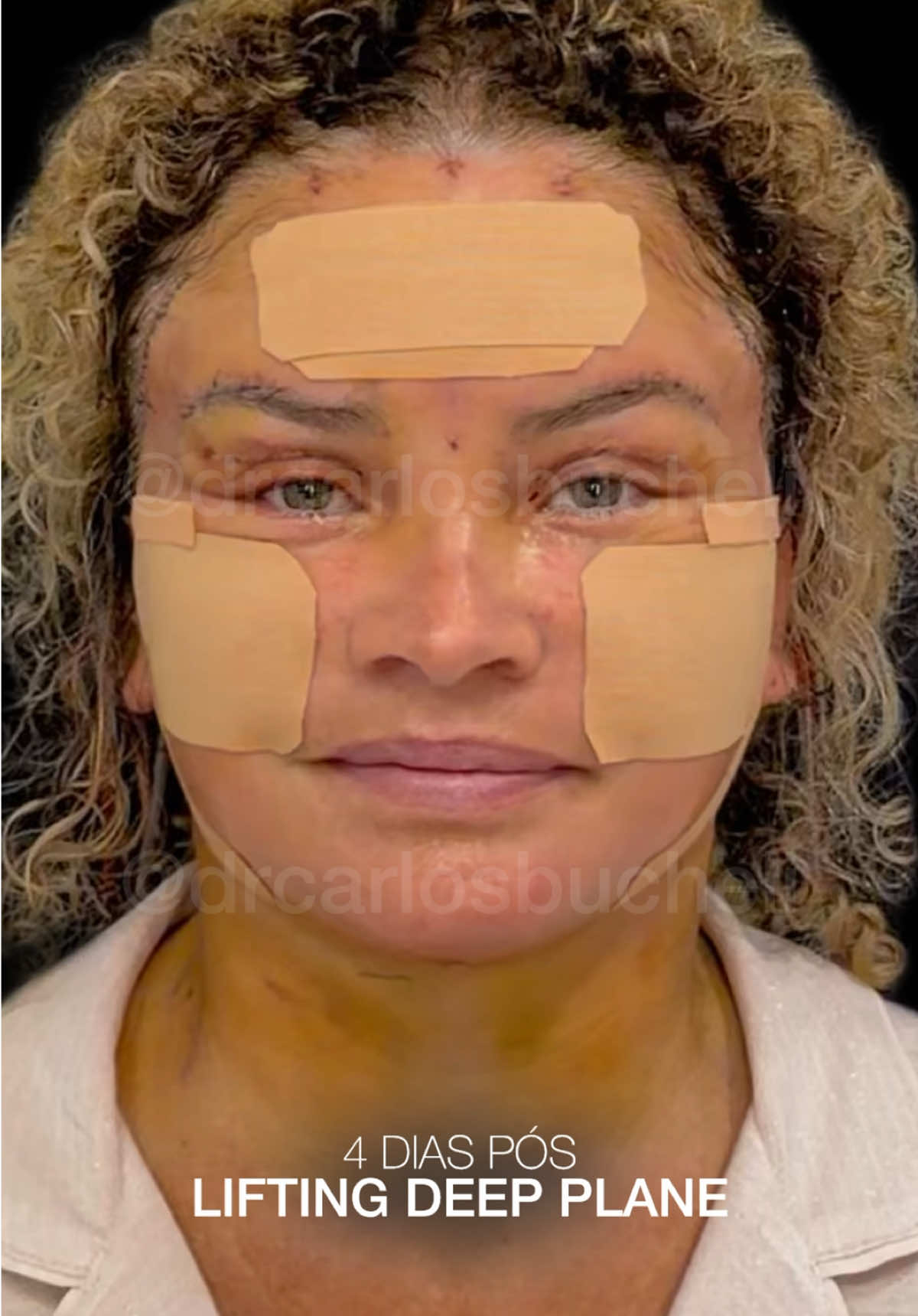 @Dr. Carlos Bucheli