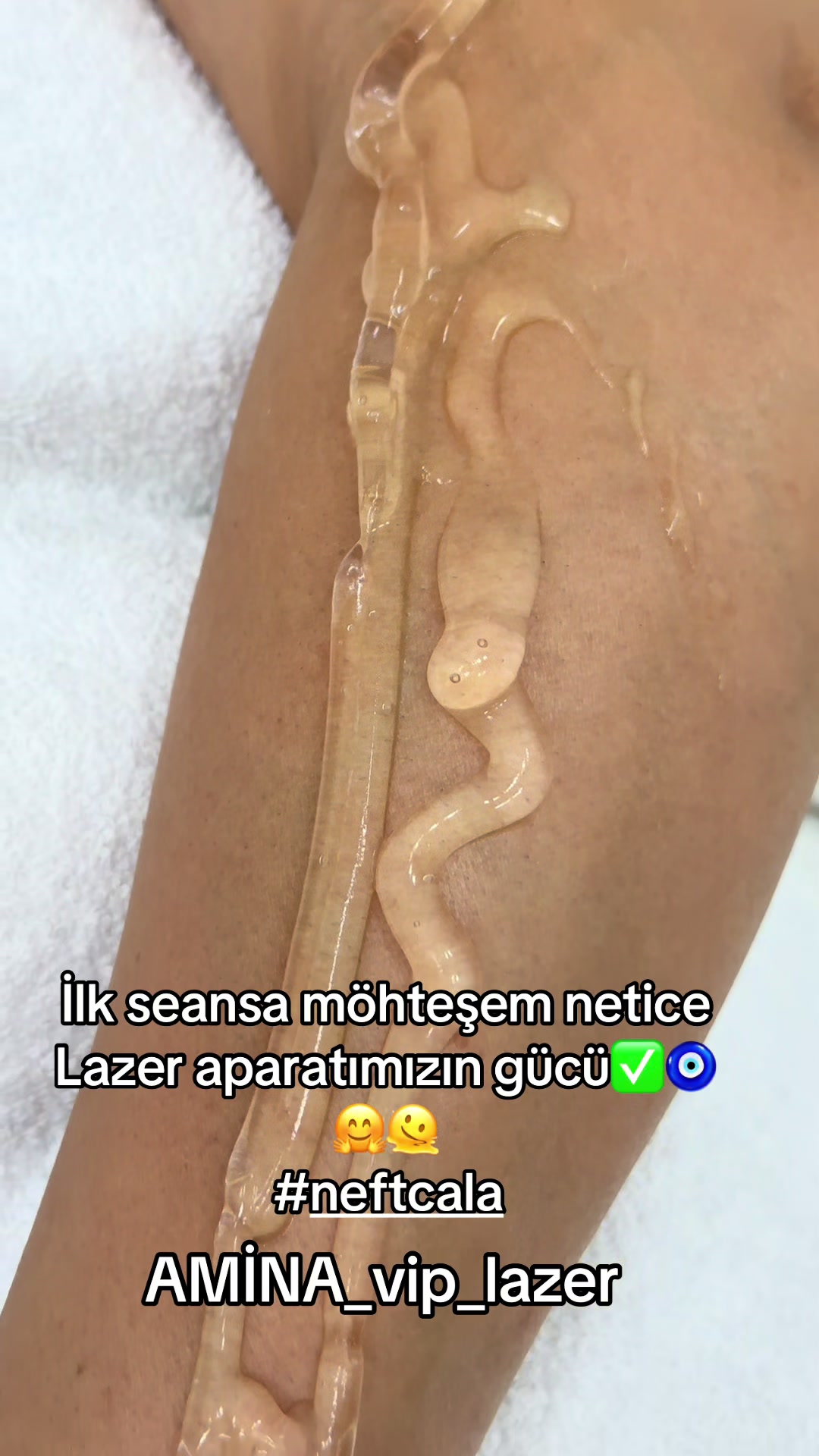 @Neft&ccedil;ala_Stilist_Emine