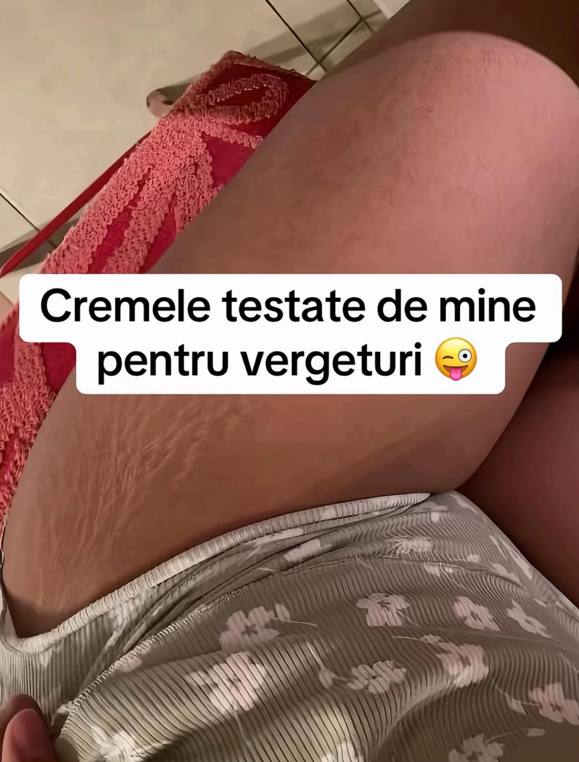 @Patch&eacute;lle | Link in bio 💕