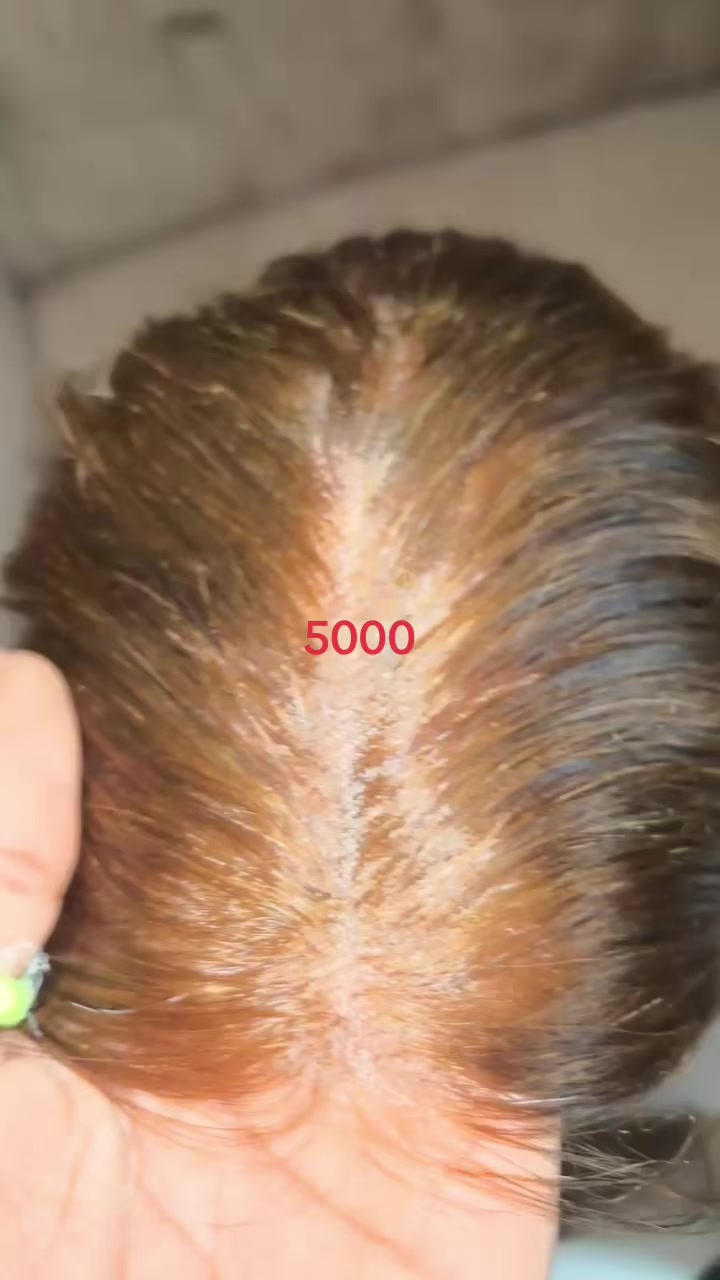 @Vide sp&eacute;cial cheveux