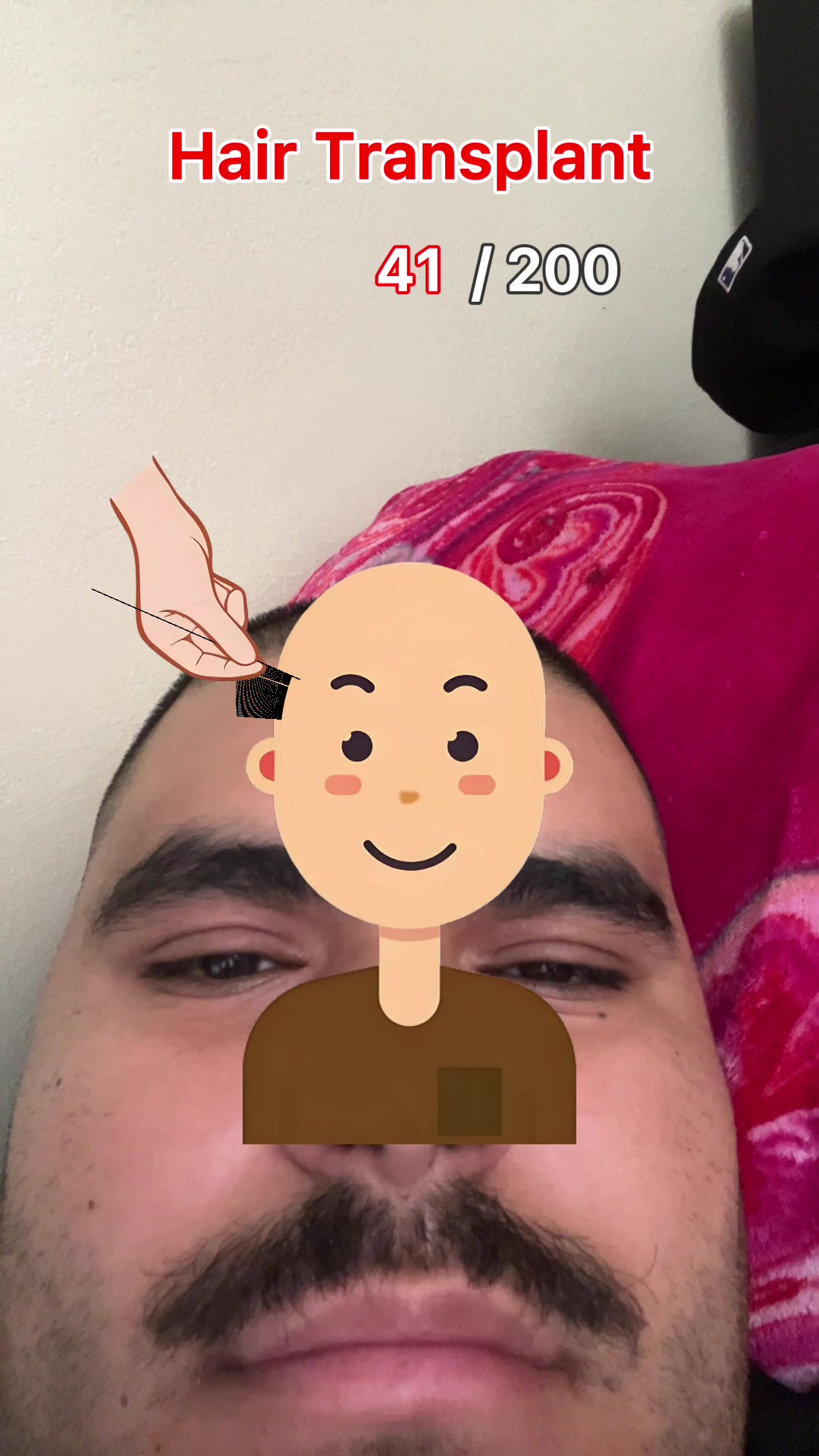 @BryancarrilloKnucklesechidna