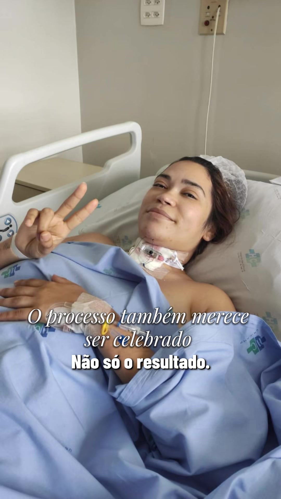 @Chay