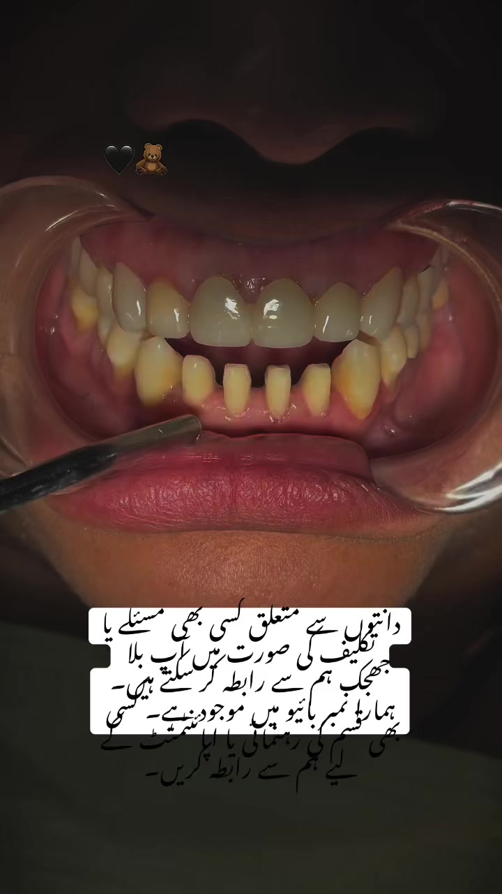 @Aun dental clinic ❤️