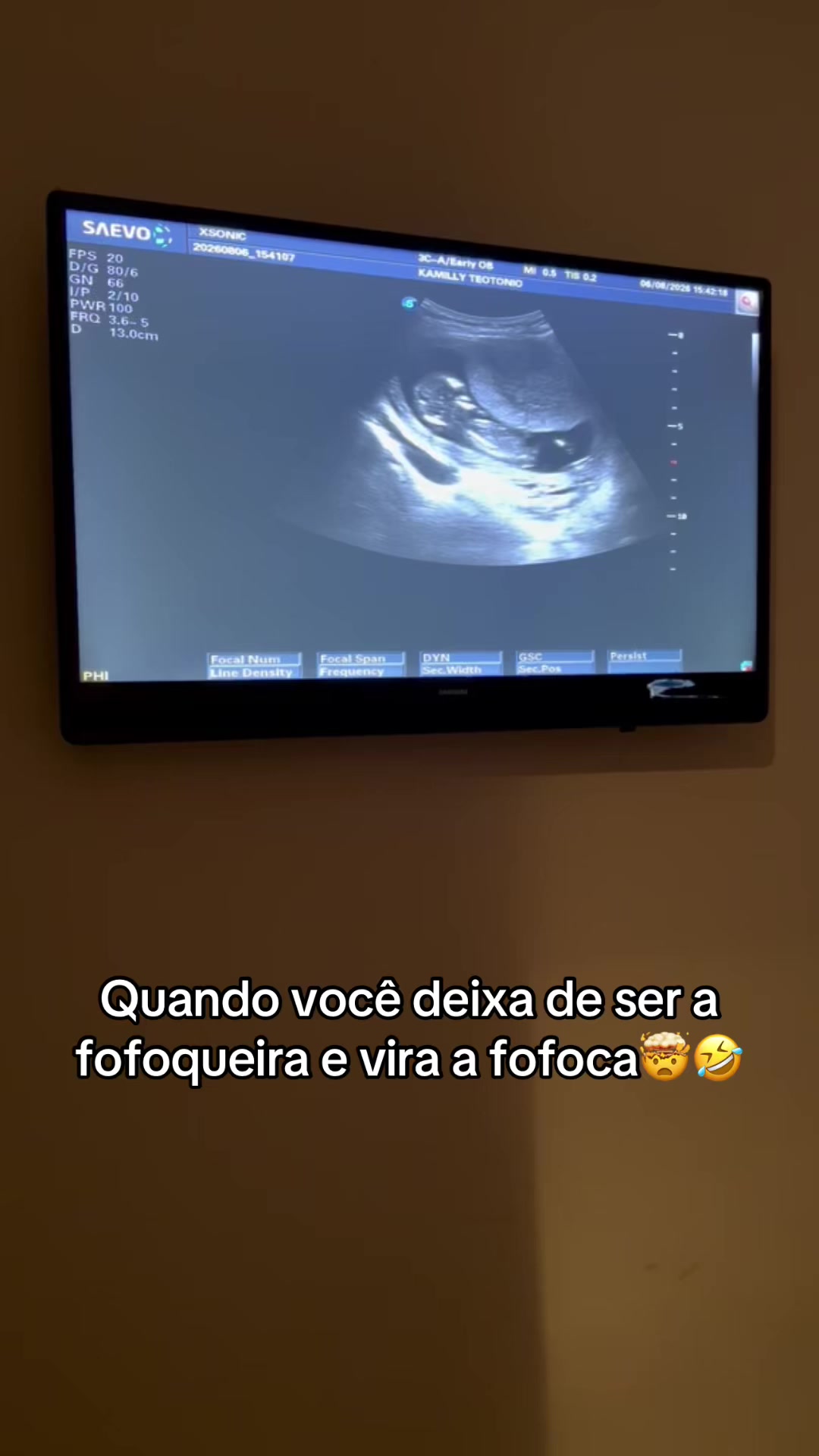 @Kamilly Teot&ocirc;nio