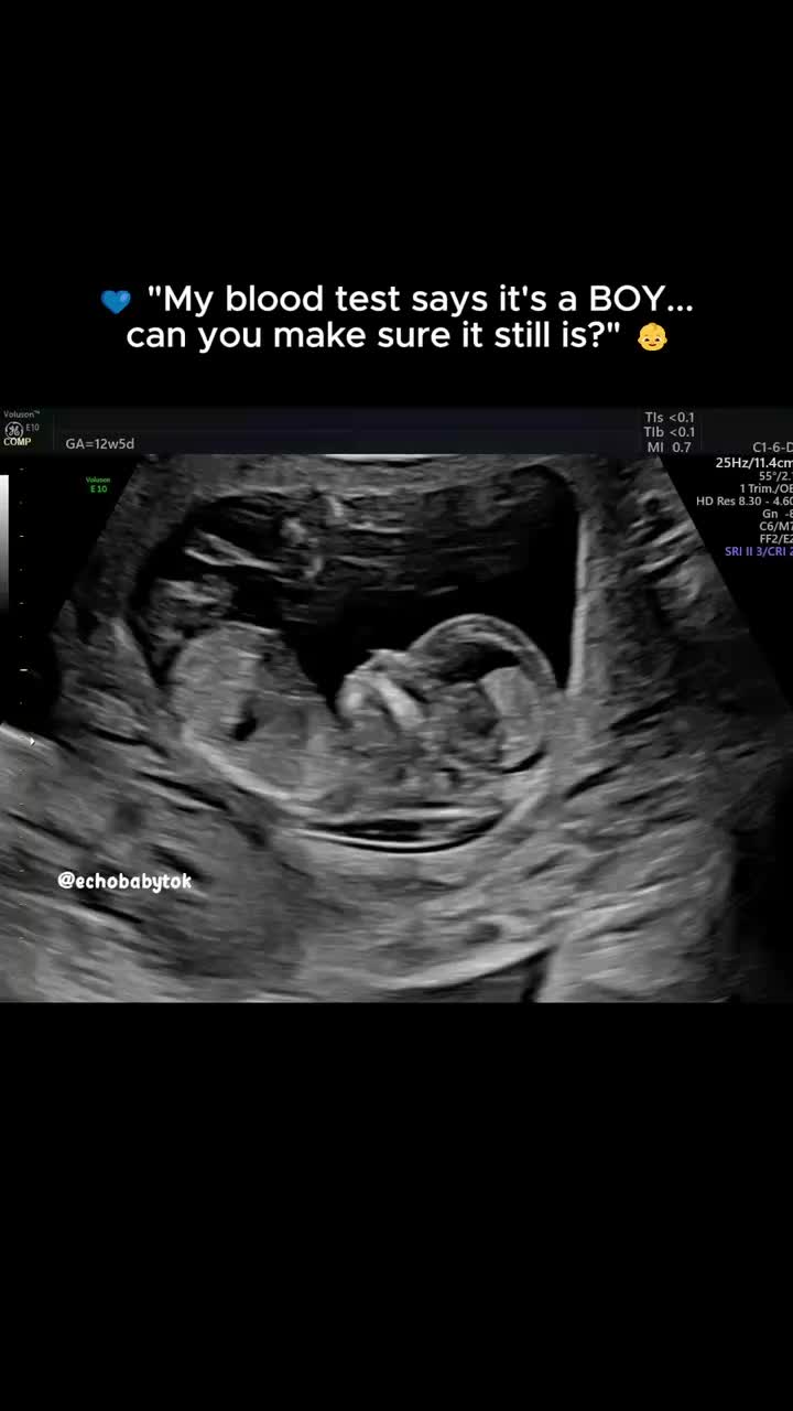 @Echobaby