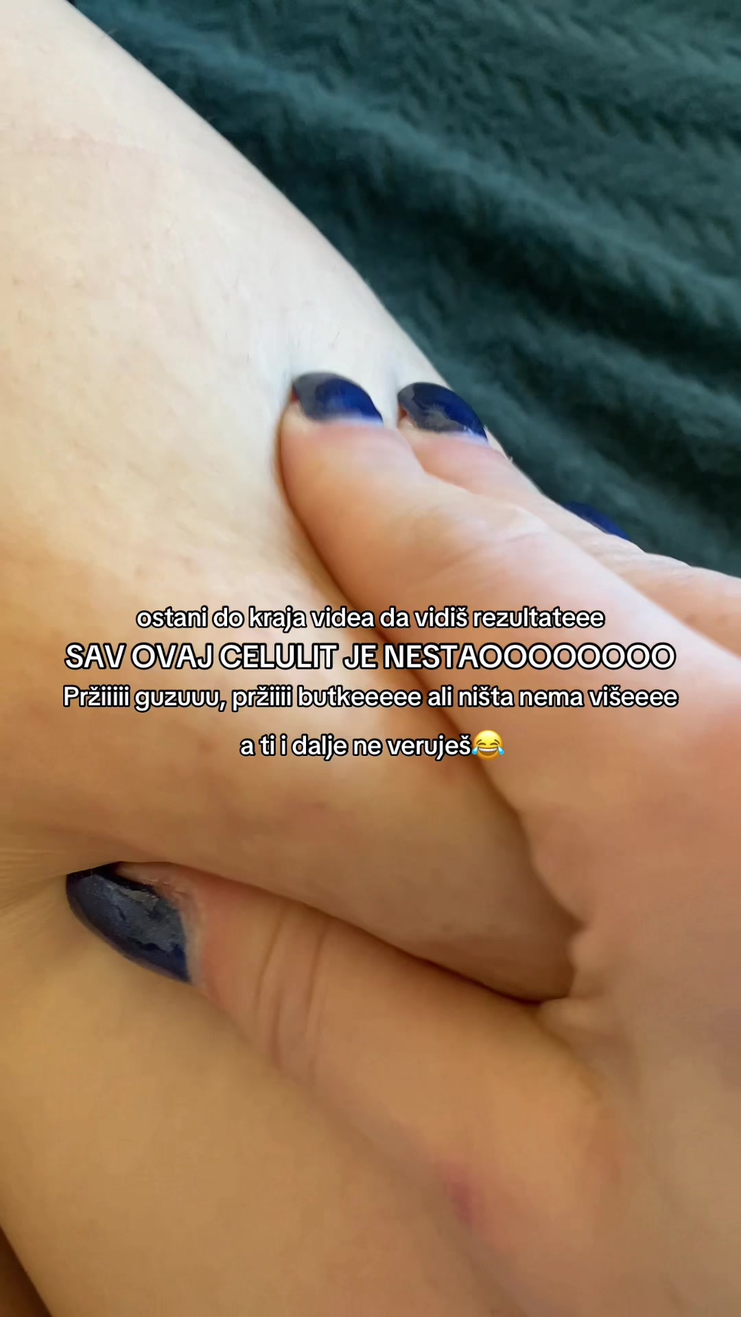 @Re&scaron;i se celulita i kilograma🌼