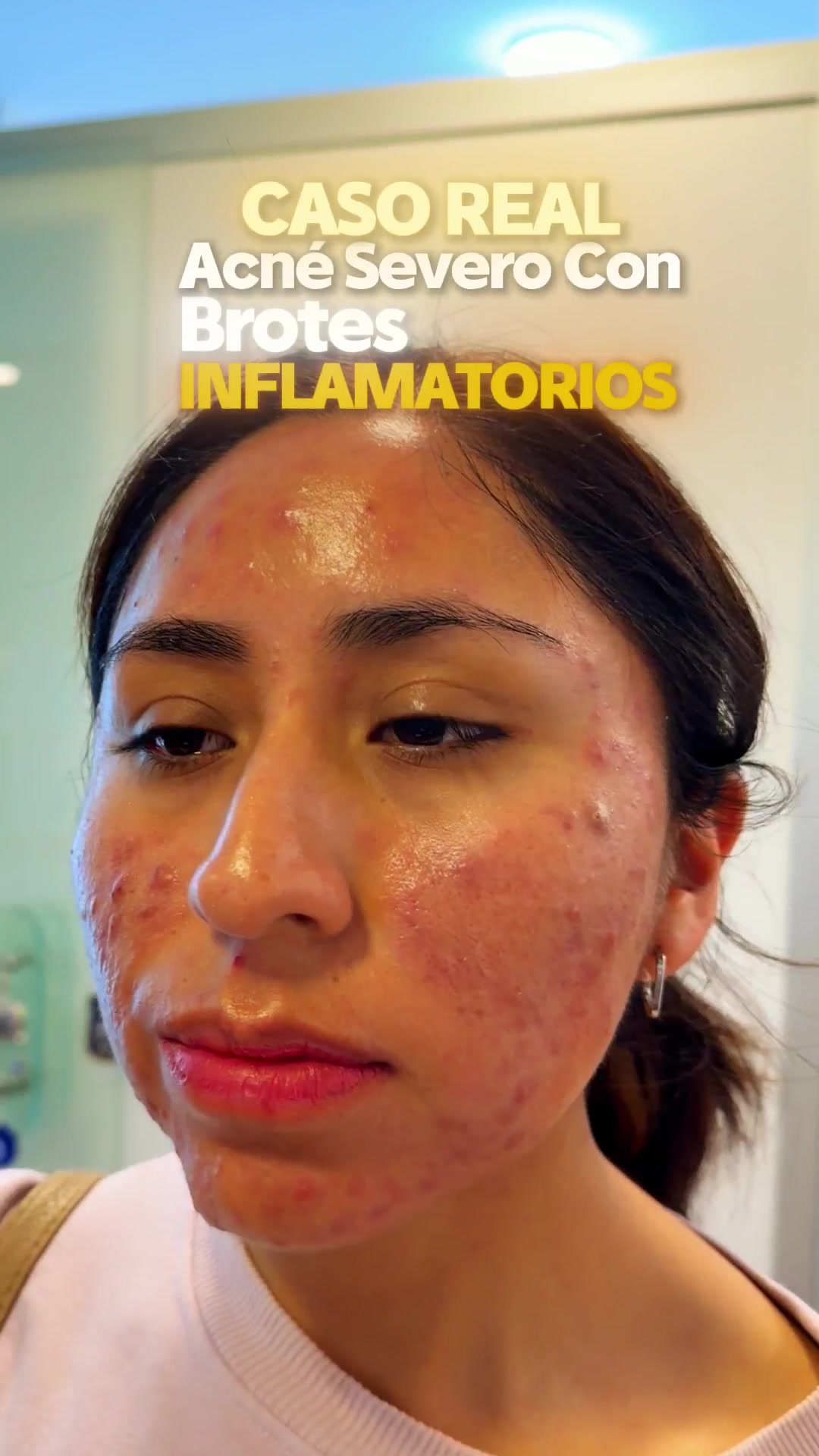 @RebellSpa