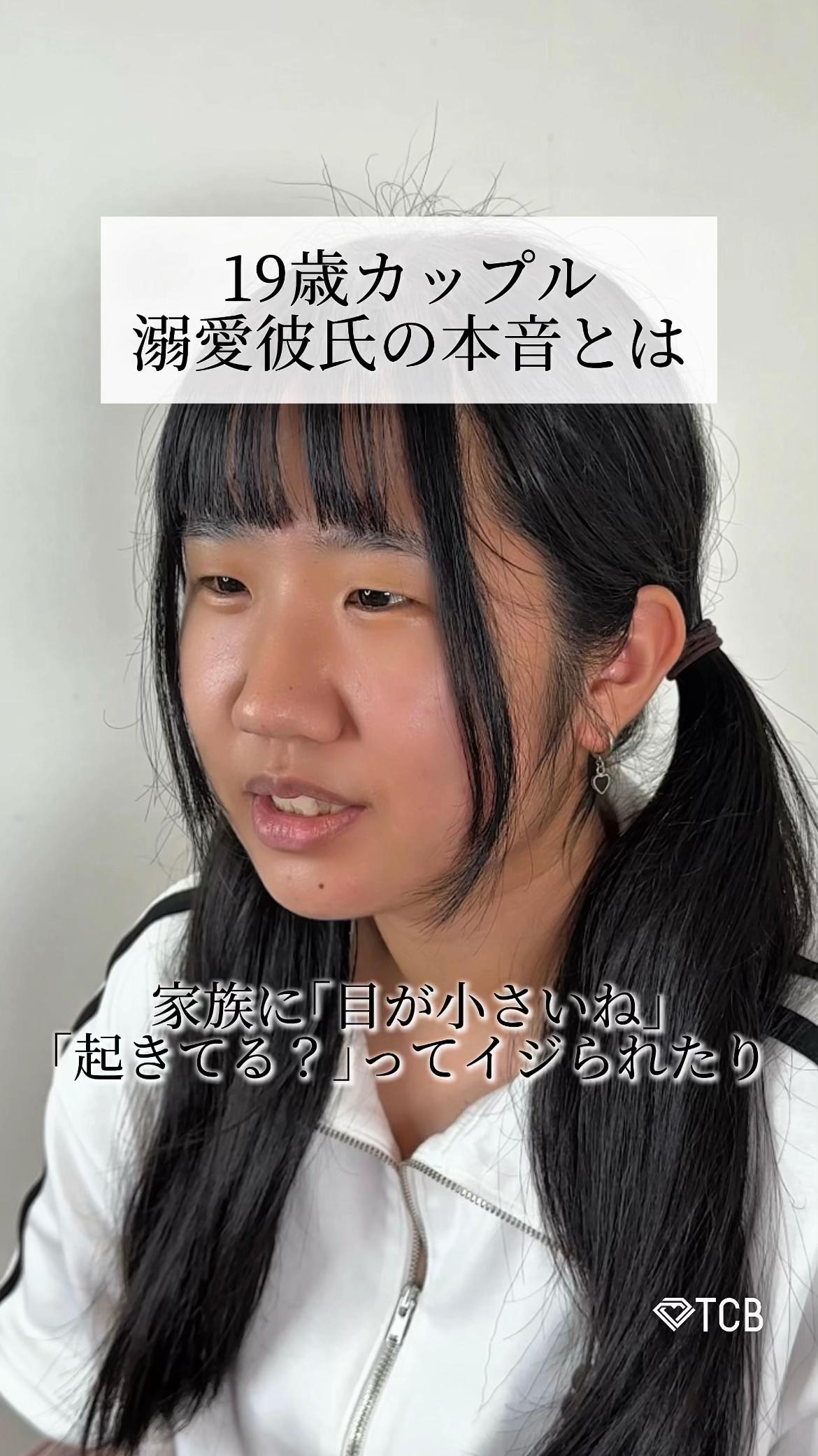 @【二重整形】TCB 新宿東口院ゆいこ先生/東京