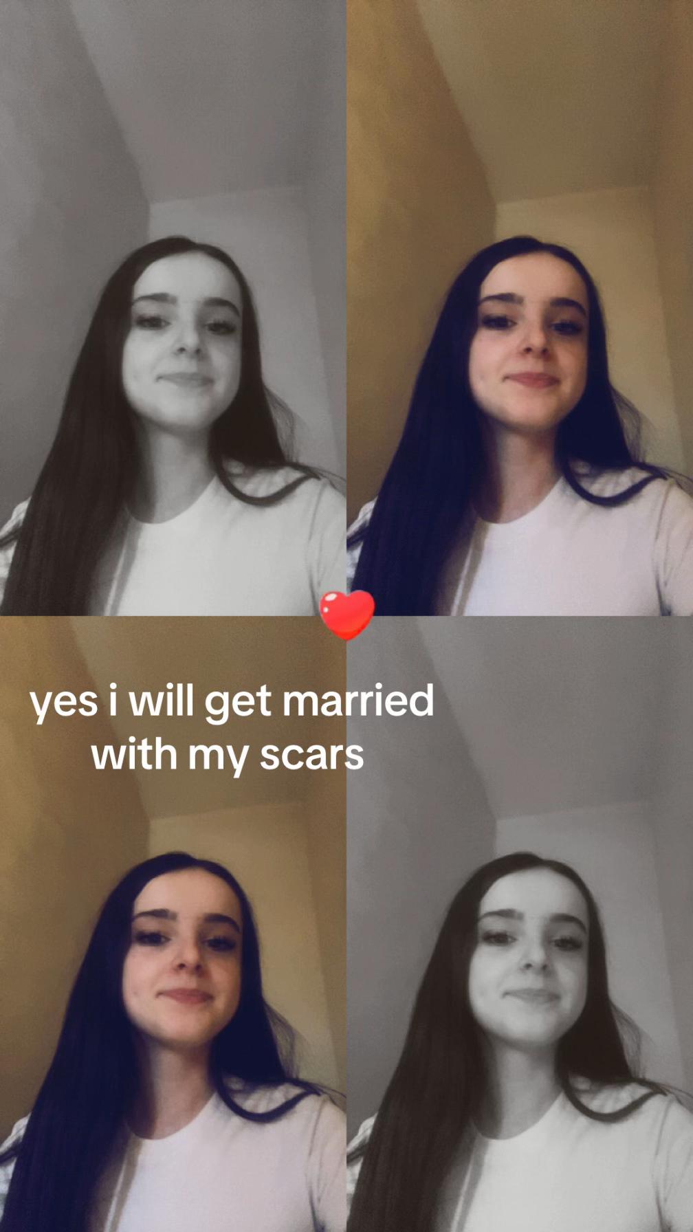 @𝓈𝓅𝒶𝓂𝒶𝒸𝒸🫶🏽🫶🏽