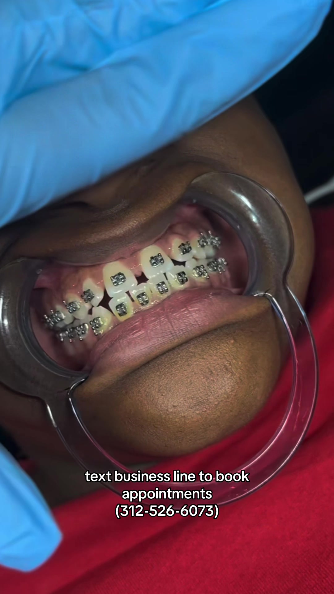 @🦷