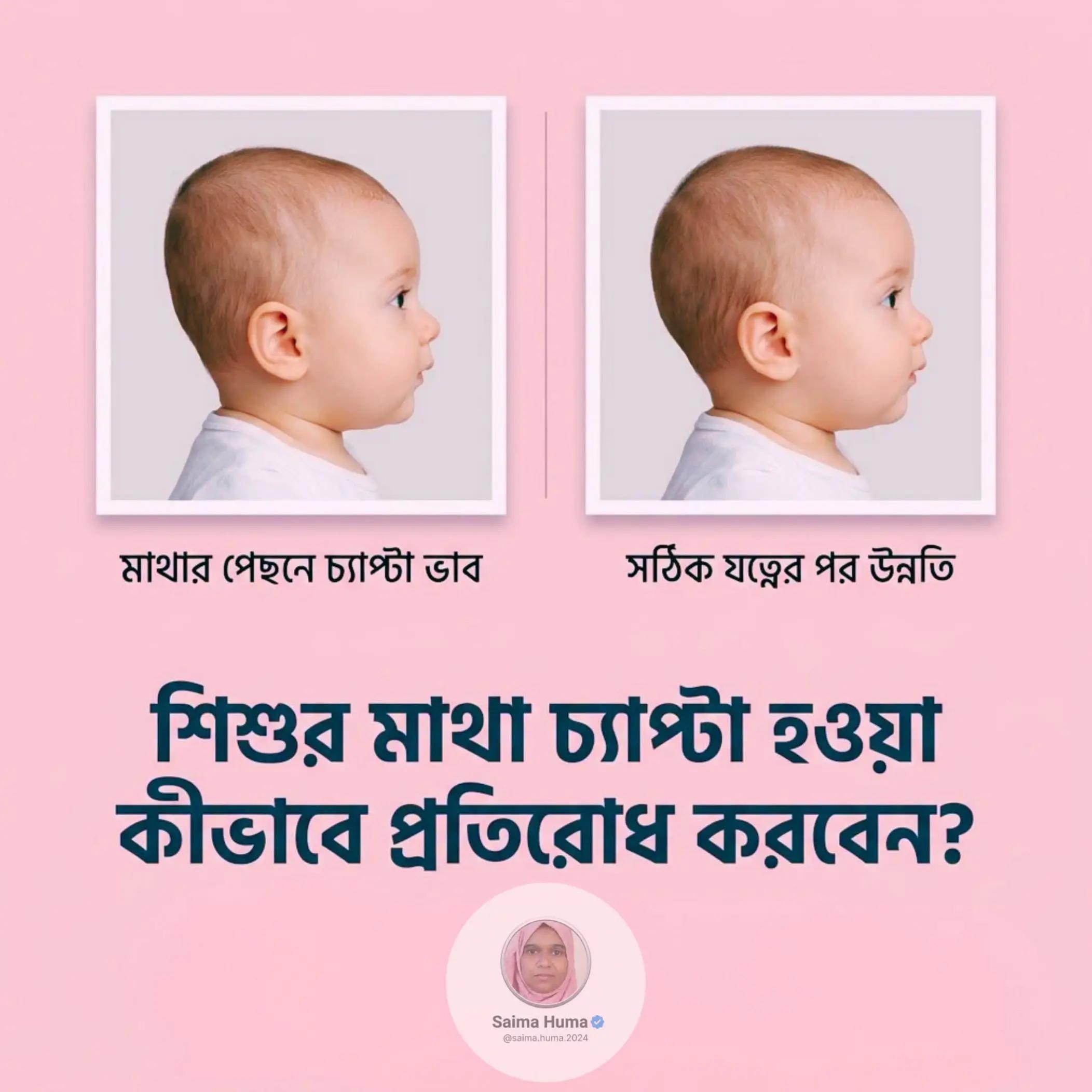 @Saima Huma