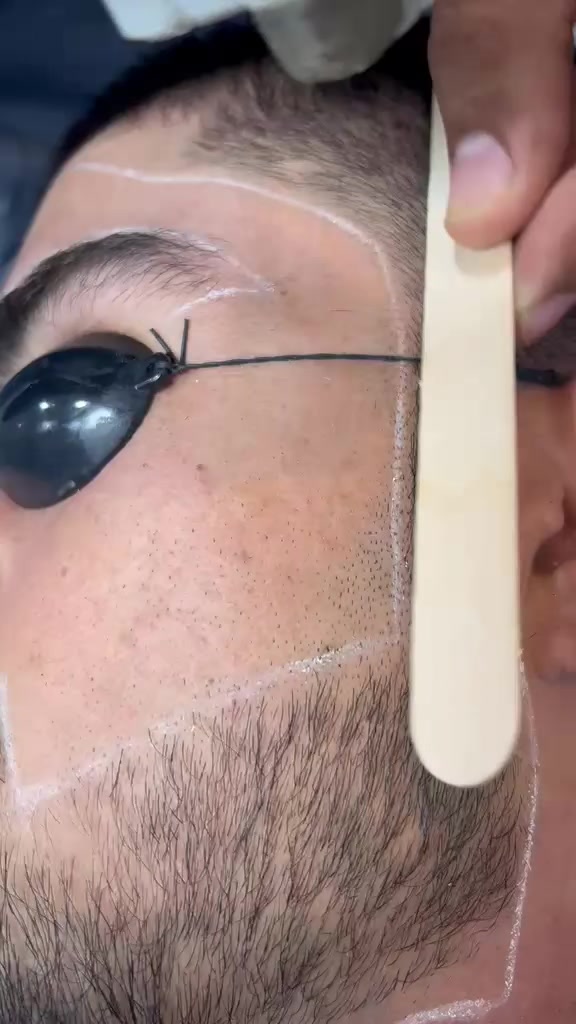 @Laser Grafix clinic