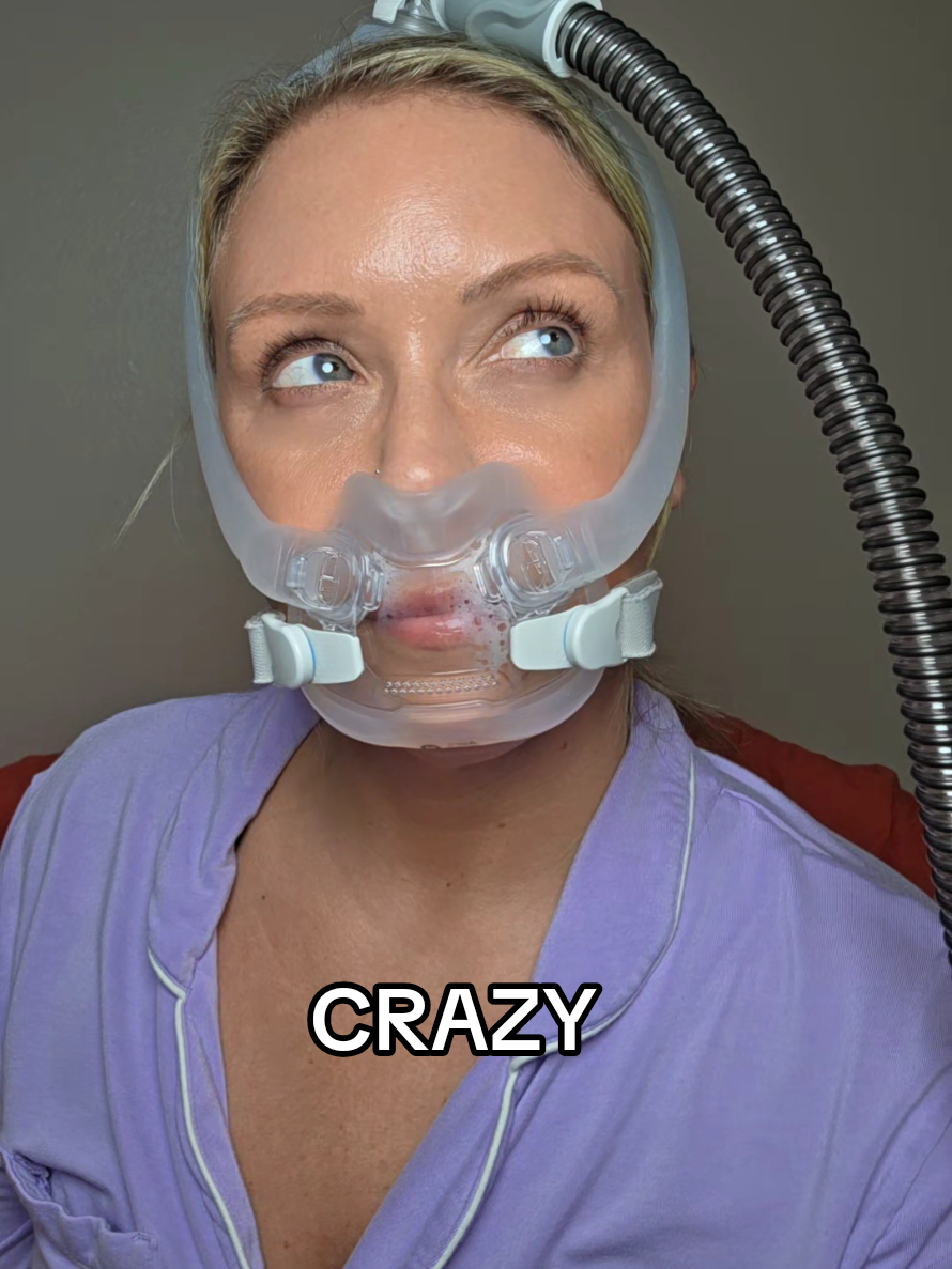 @LeAnn Day | CPAP