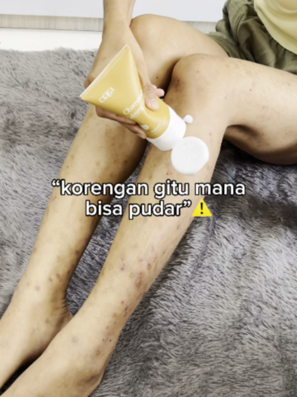 @Ciara Indonesia
