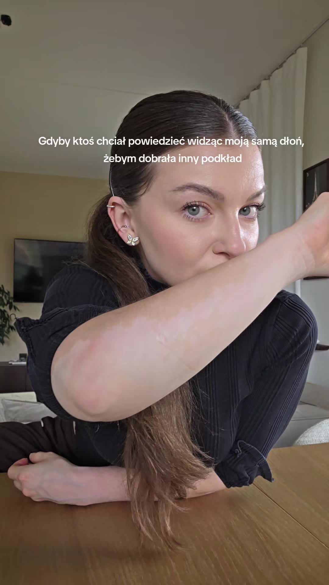 @vitiligo.girl