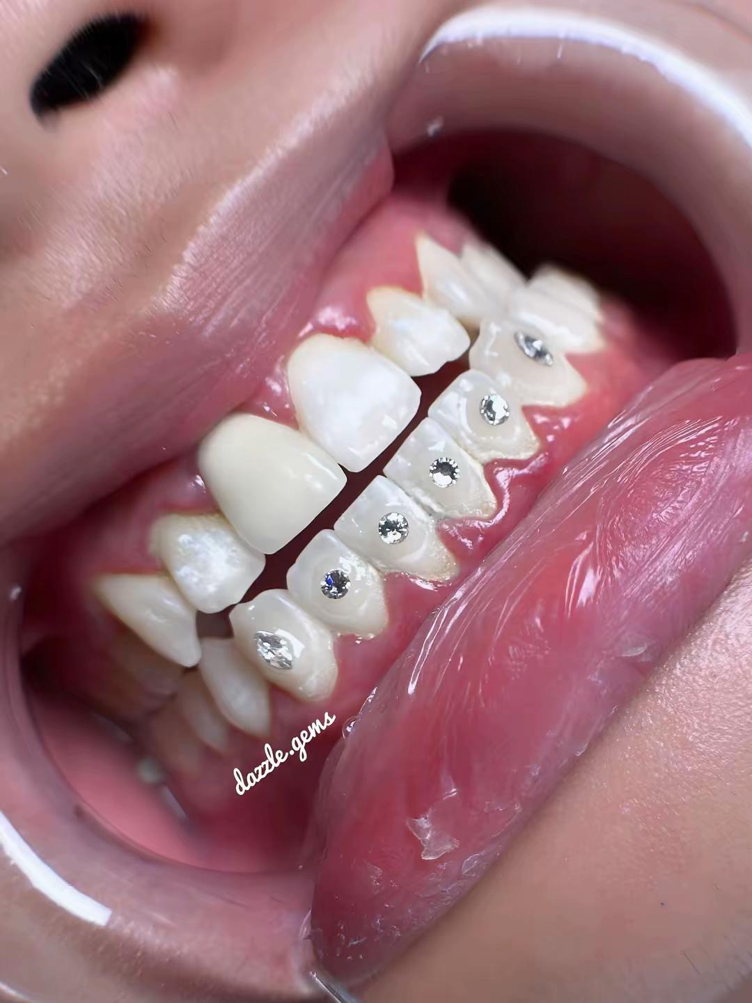 @Piercing - Toothgems