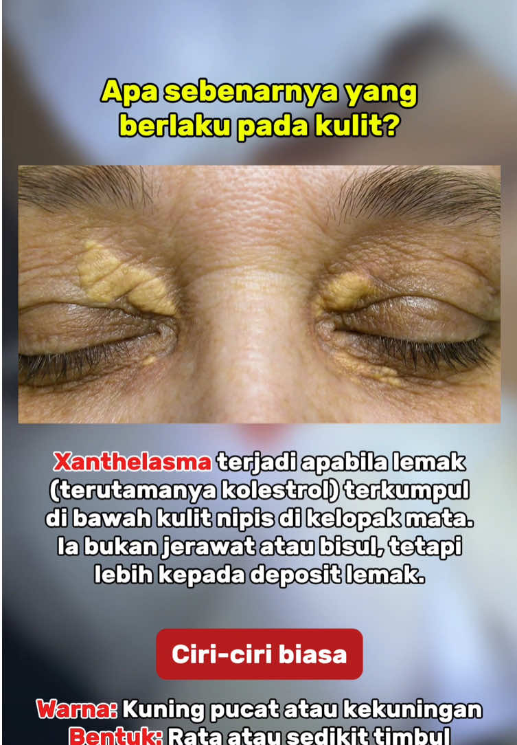 @Dr.Lyna Kulit.Aesthetic.Laser