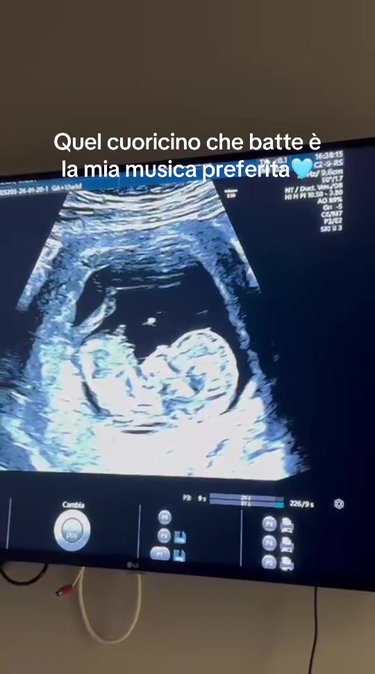 @lapugliese