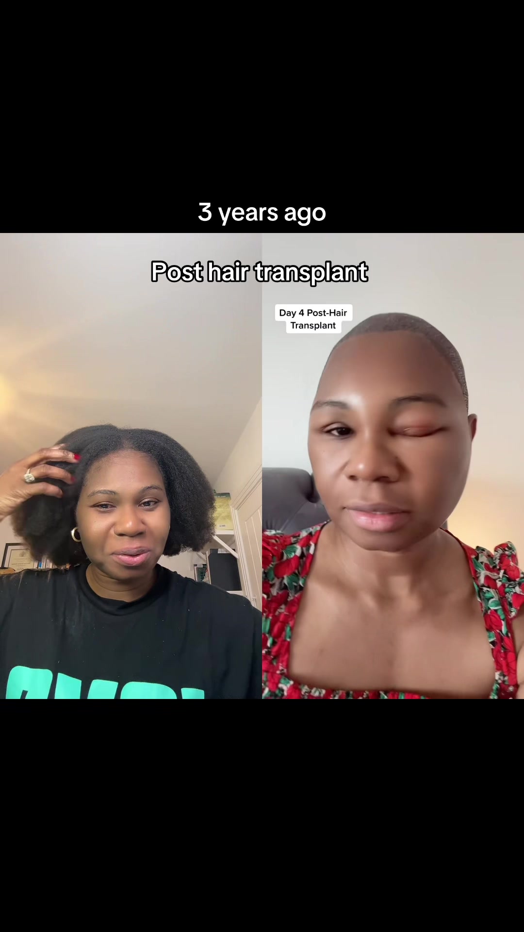 @Myafrotransplant