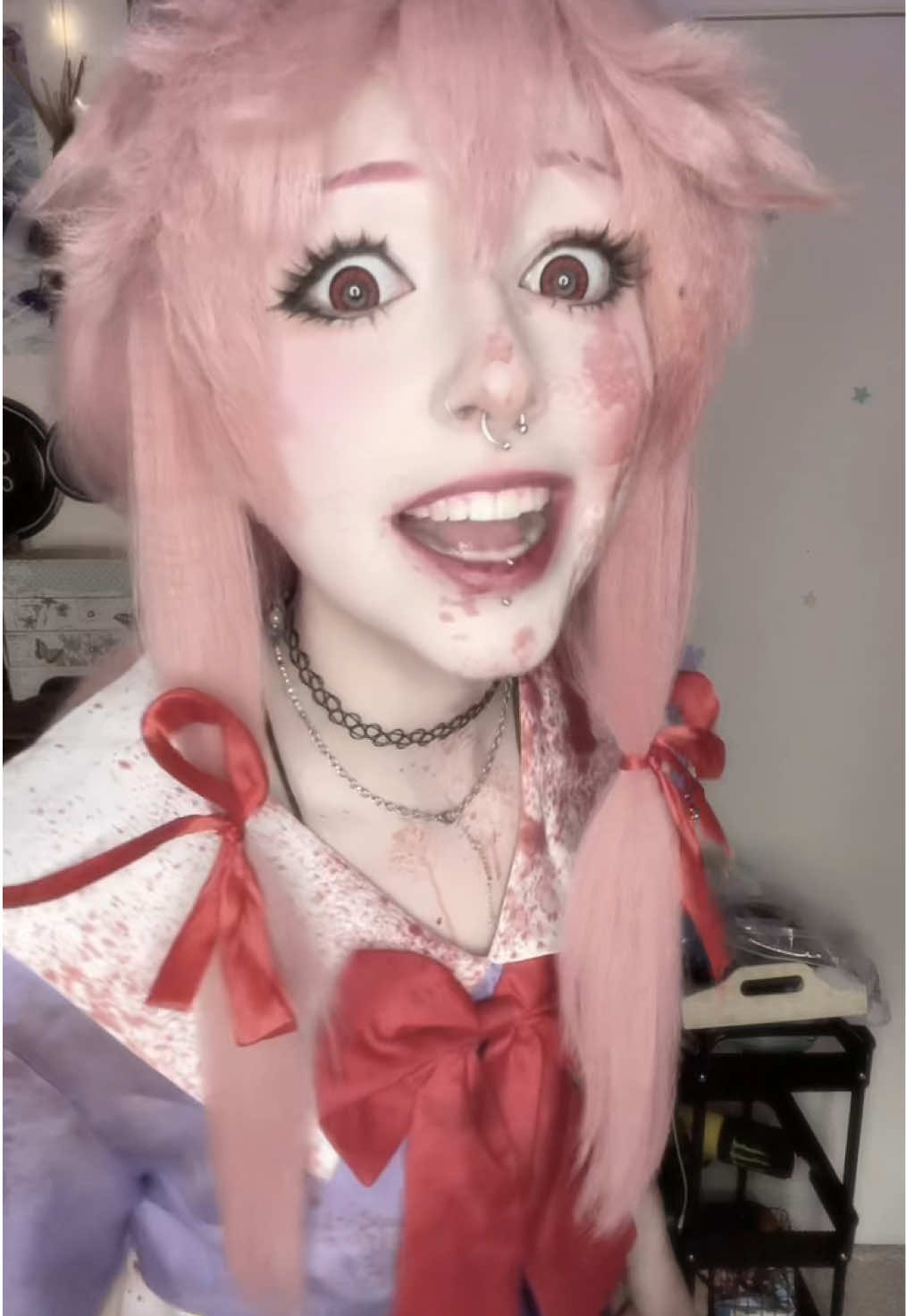 @Xoe