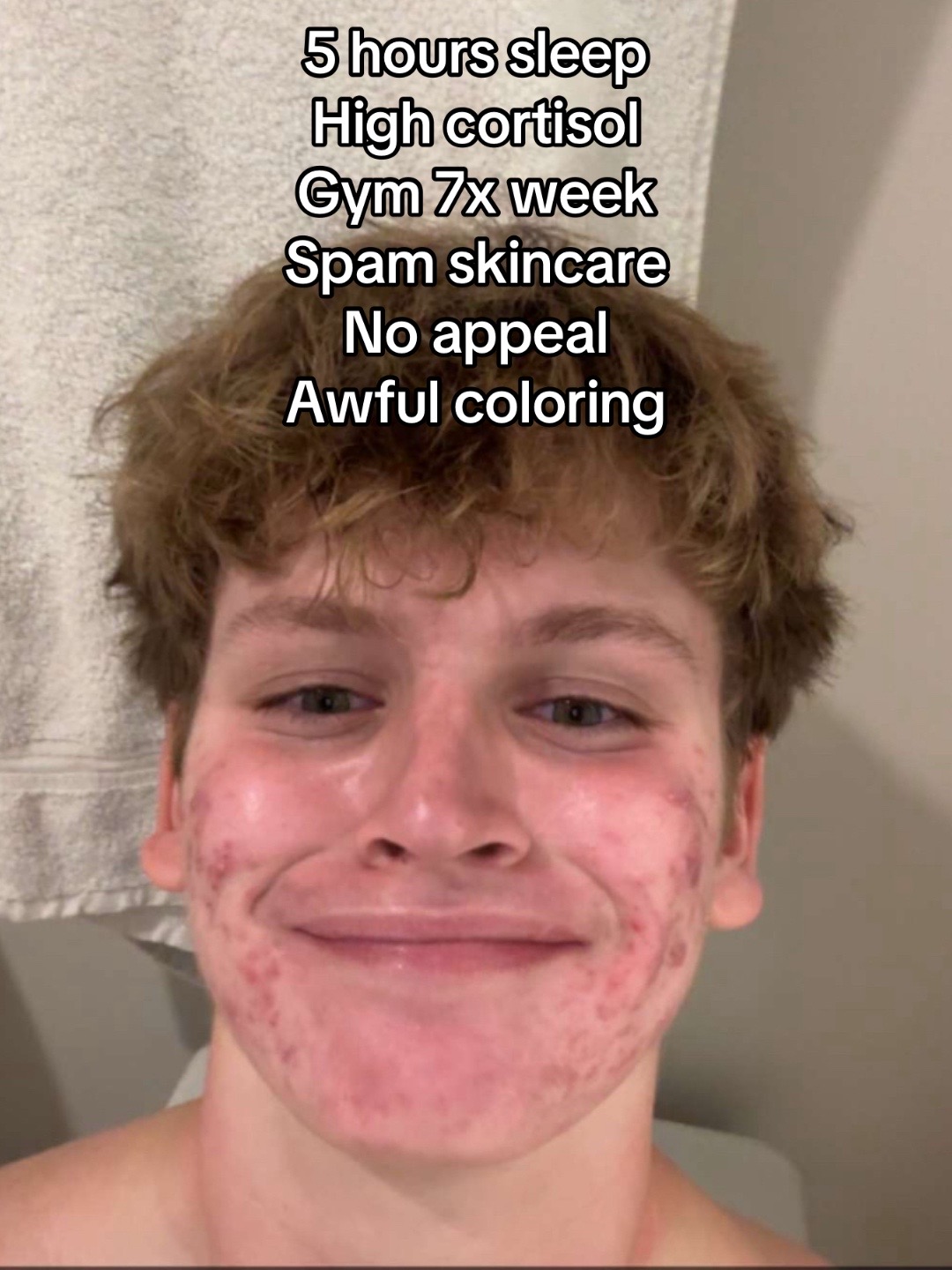 @PG