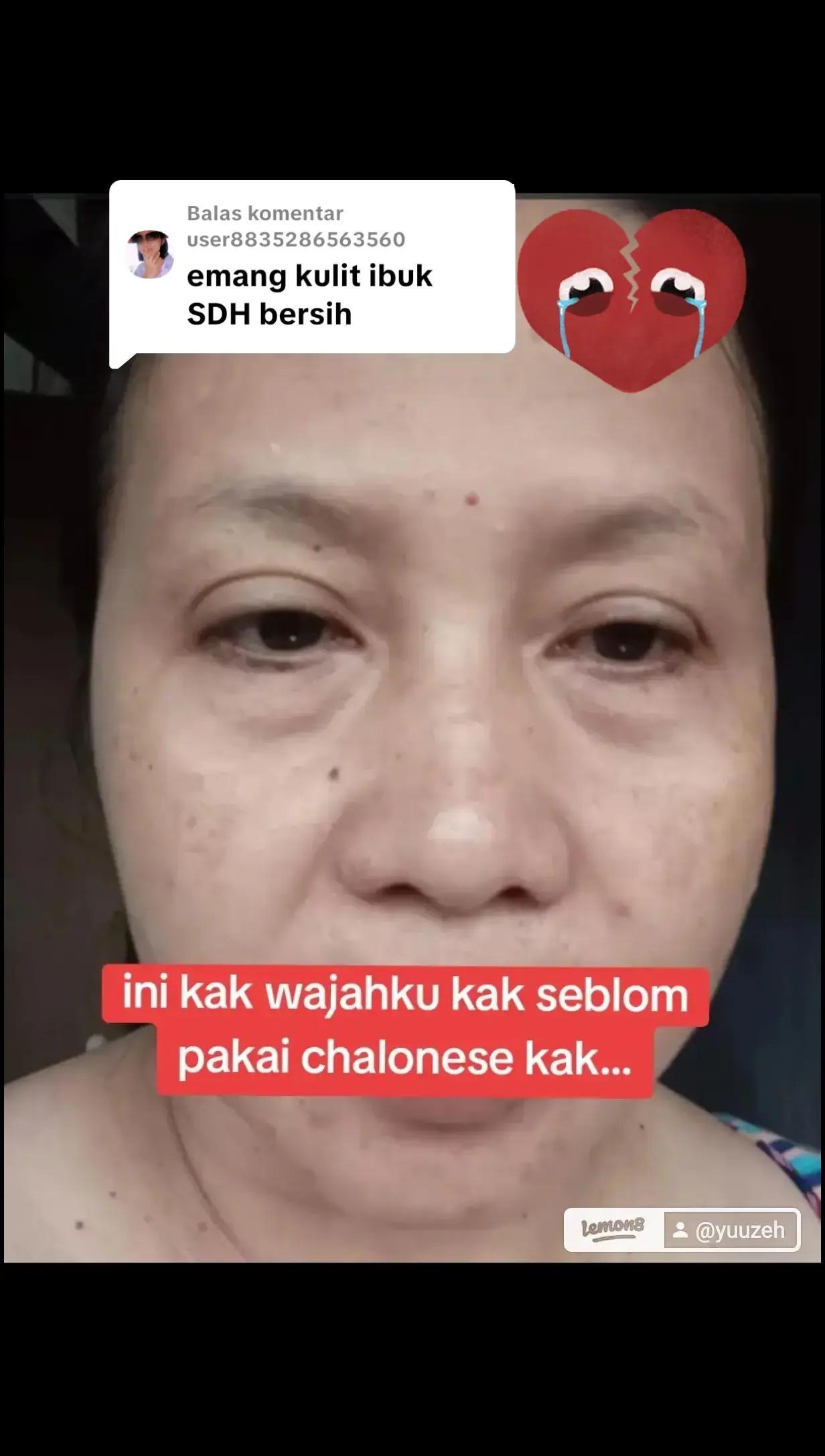 @YUUZEH
