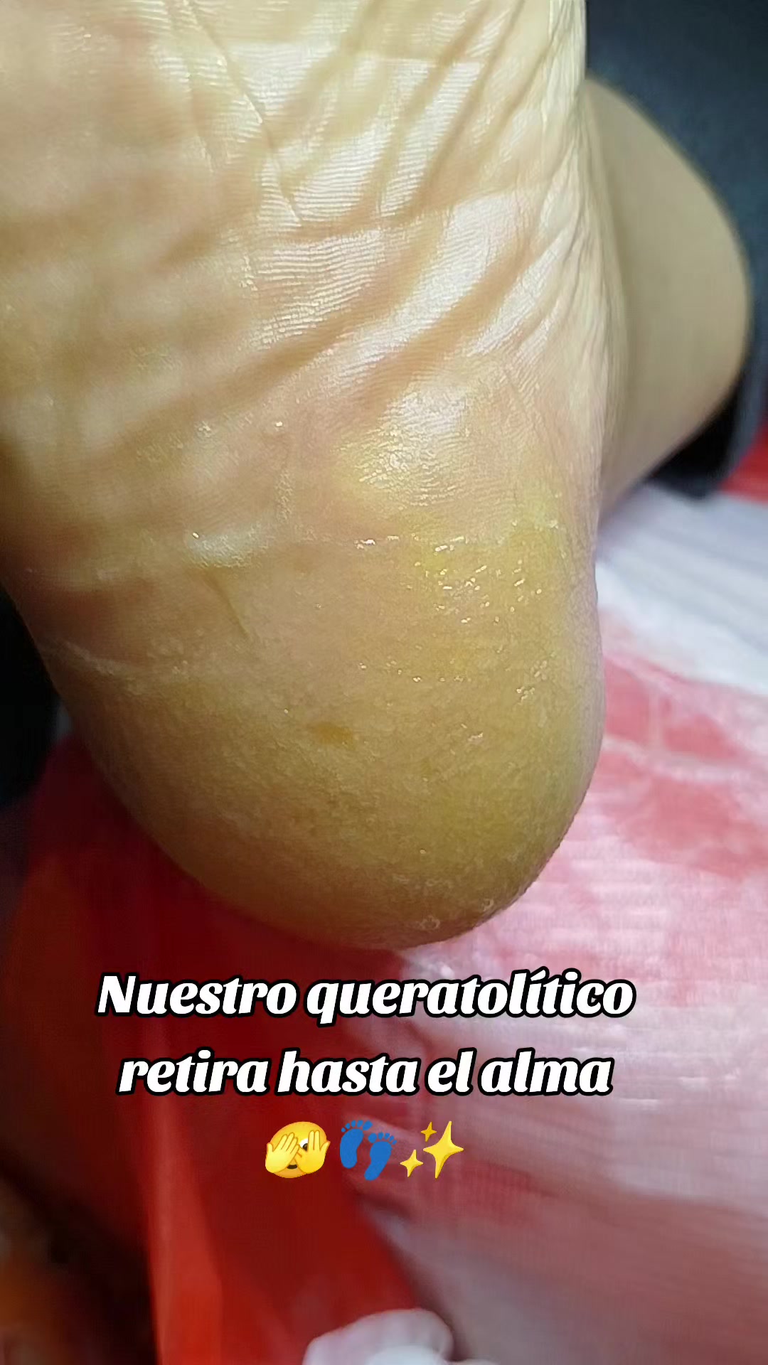 @Podom&eacute;dical🇵🇪