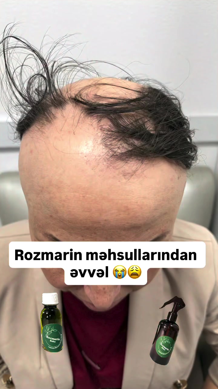 @rozmarinbaku