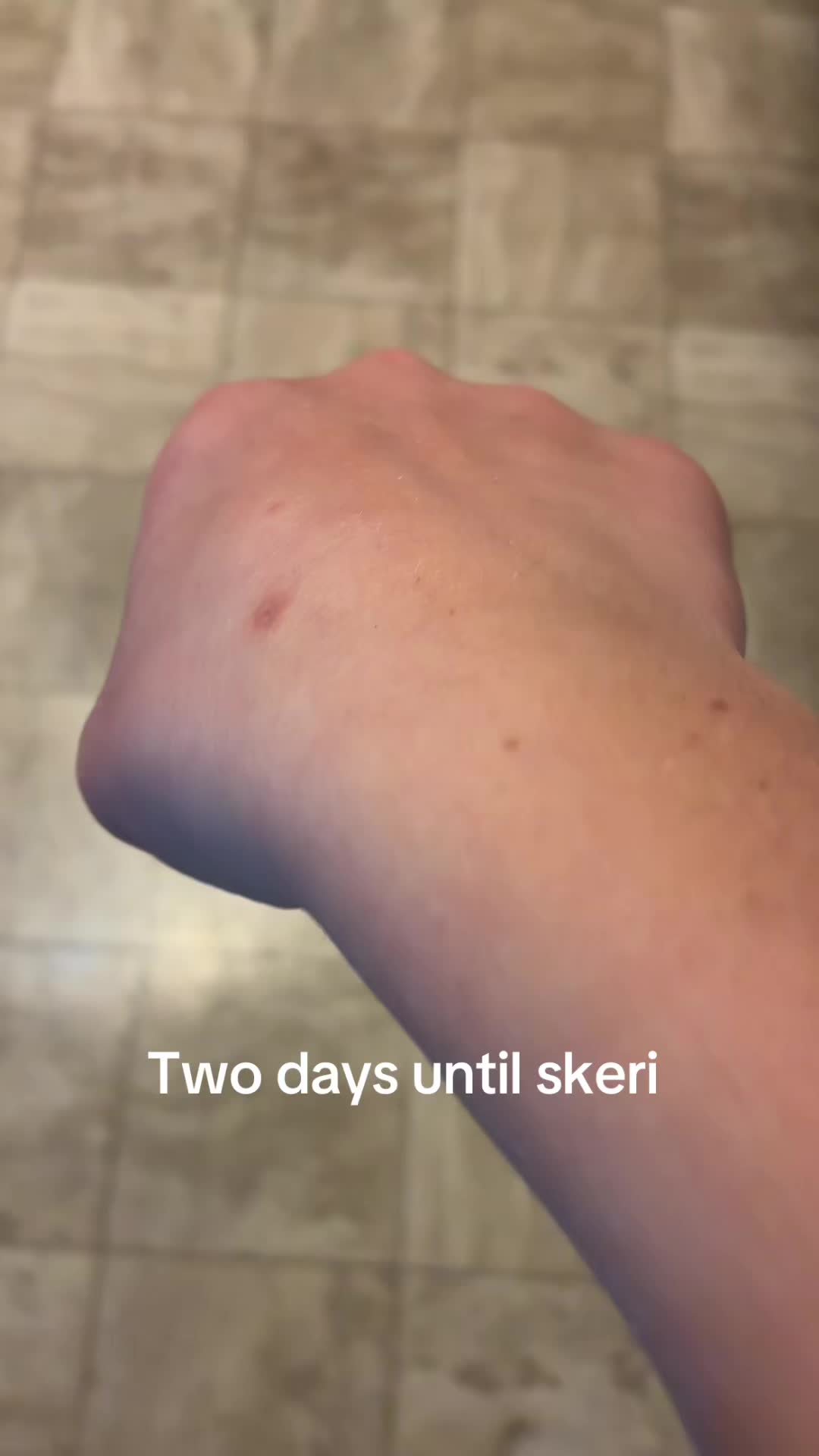 @tylerskaar