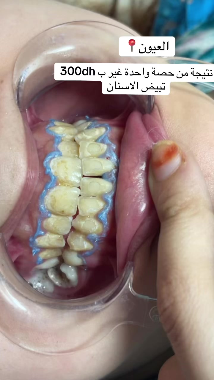 @Nadira El Kamel