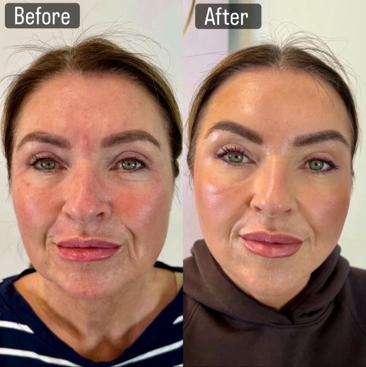 @Enhanced Aesthetics Liverpool