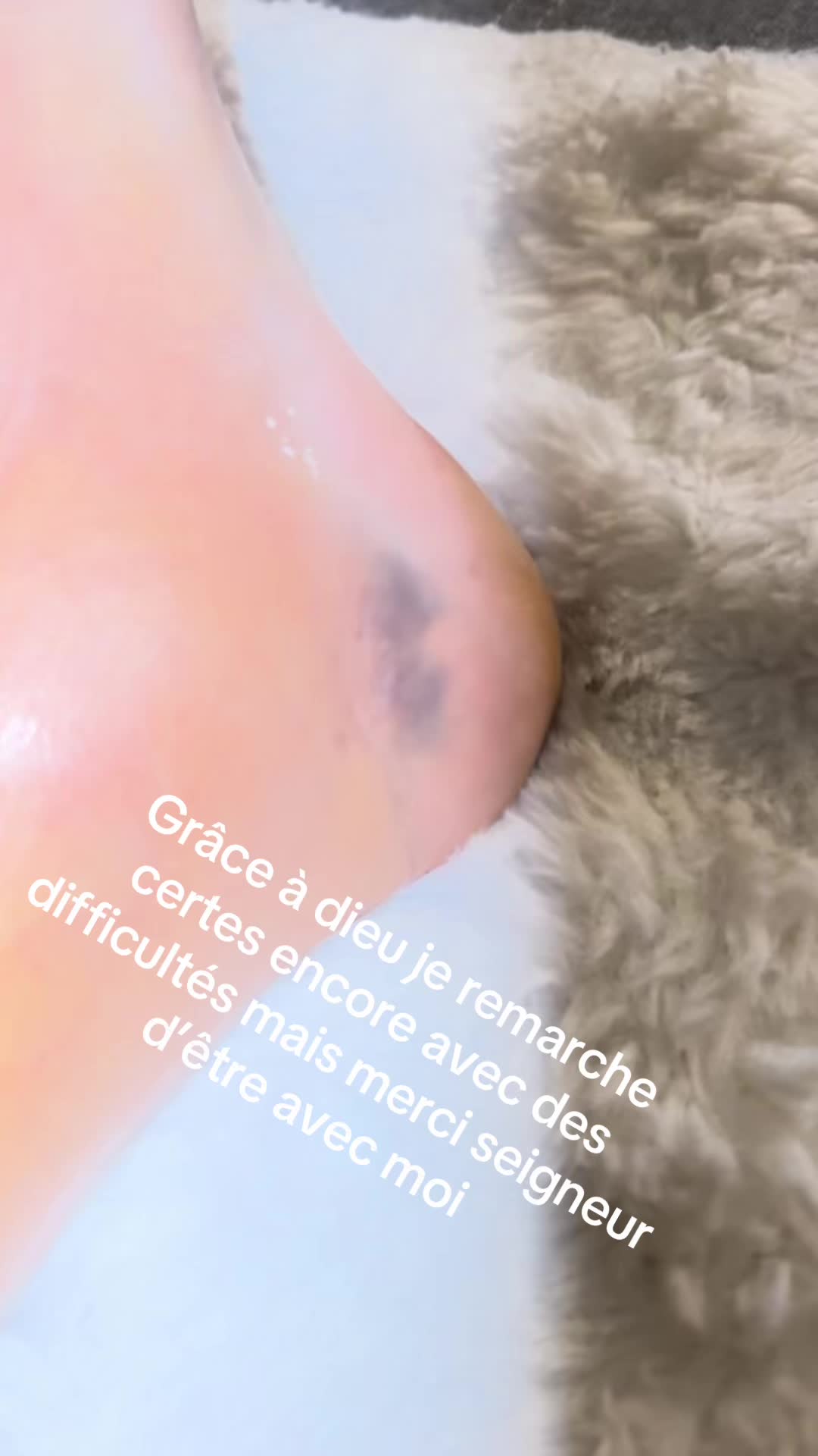 @melinda🦔